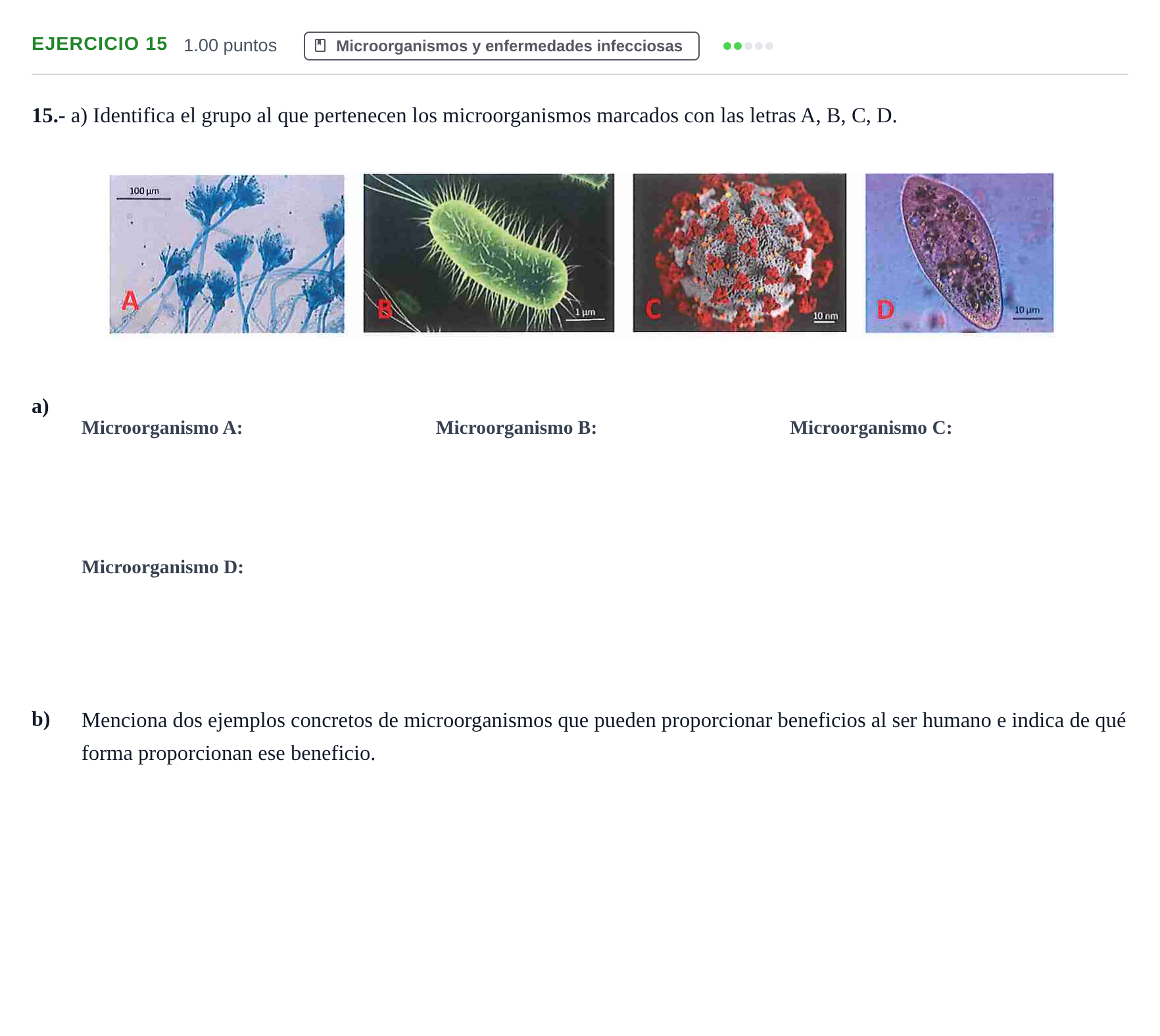 Enunciado: Problema 15 · Biología PAU Navarra Extraordinaria 2021
