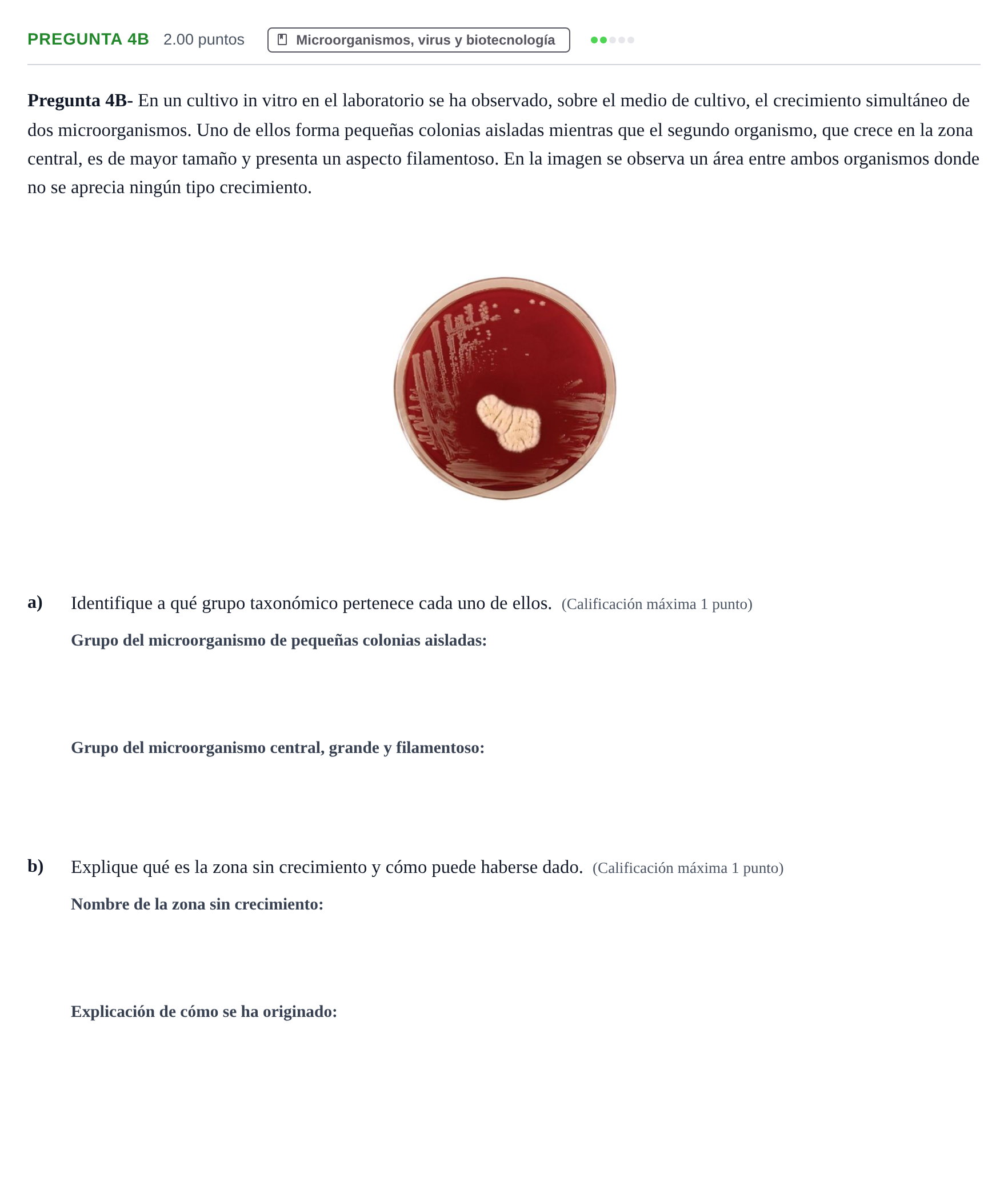 Enunciado: Pregunta 4B · Biología PAU Asturias Ordinaria 2021