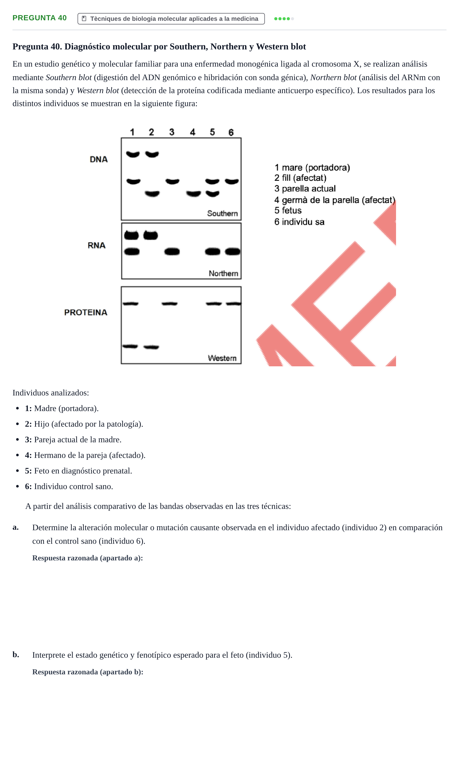 Enunciado: Pregunta 40 · Bioquímica Estructural i Biologia Molecular UAB 2025