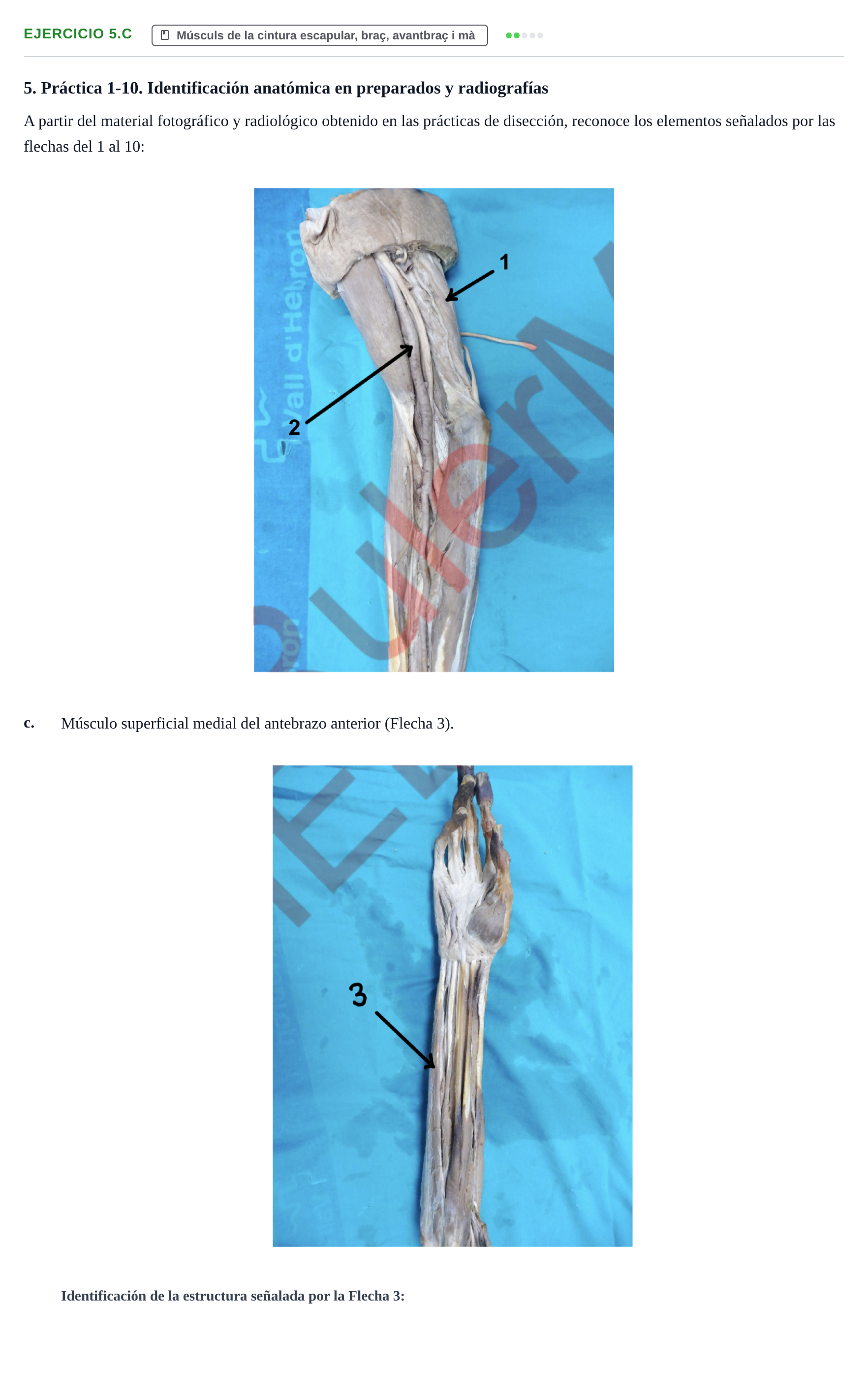 Enunciado: Ejercicio 5.c · Anatomia Humana: Generalitats i Aparell Locomotor UAB 2024