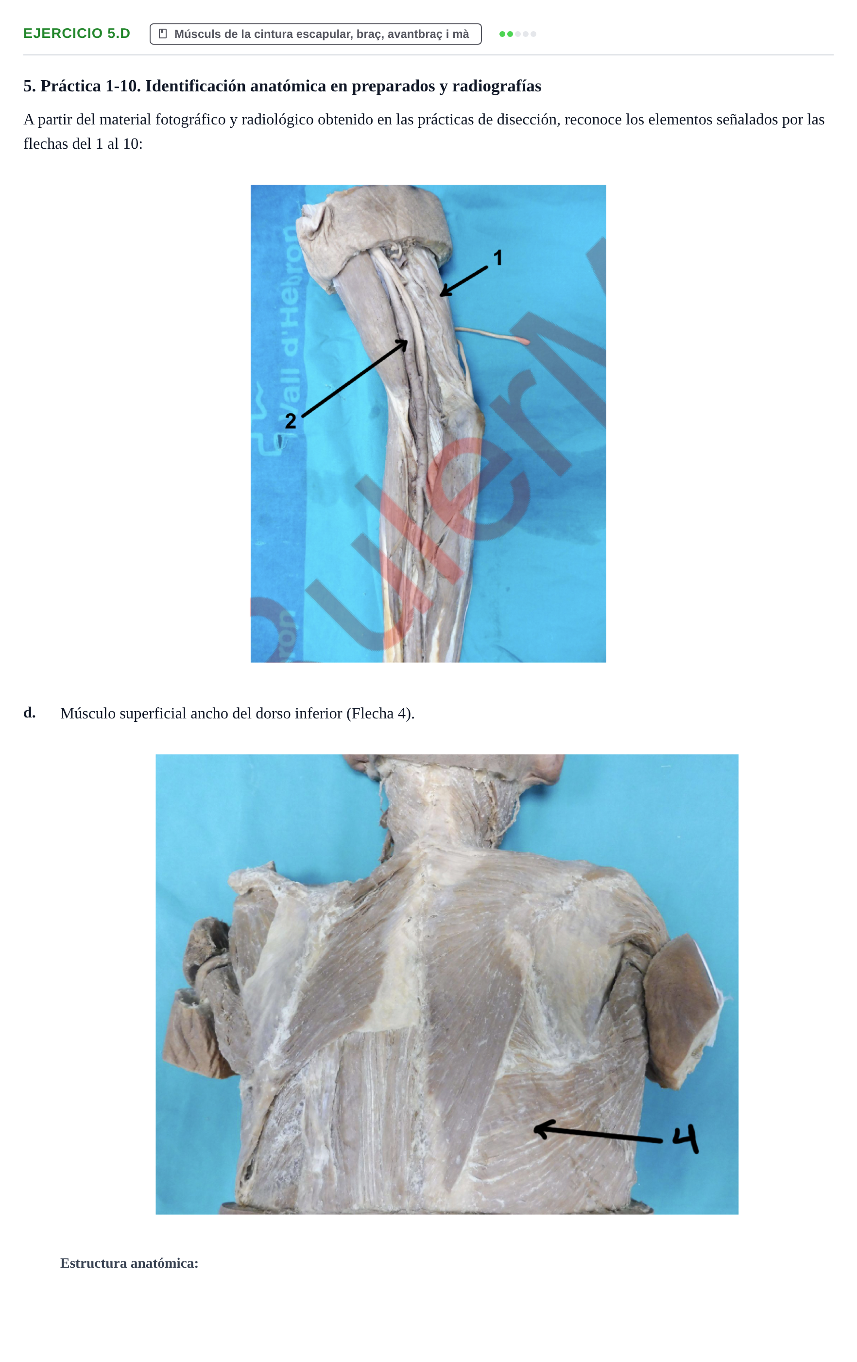 Enunciado: Ejercicio 5.d · Anatomia Humana: Generalitats i Aparell Locomotor UAB 2024