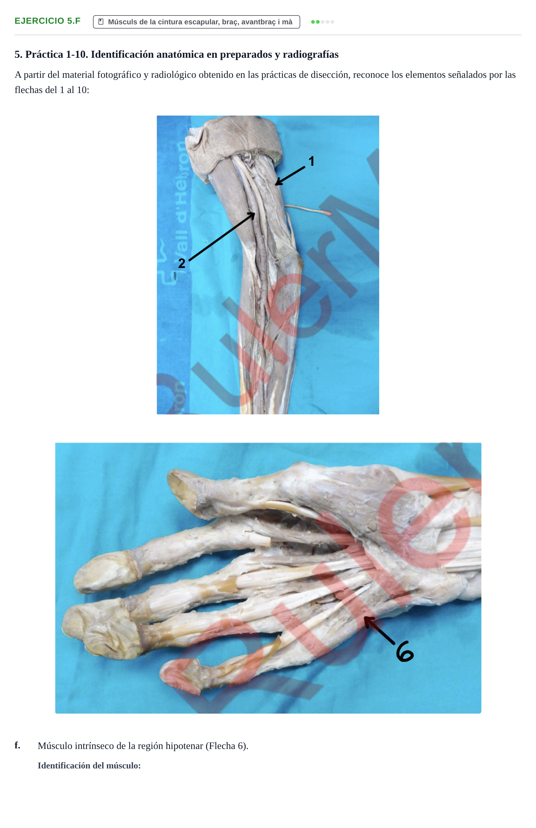 Enunciado: Ejercicio 5.f · Anatomia Humana: Generalitats i Aparell Locomotor UAB 2024