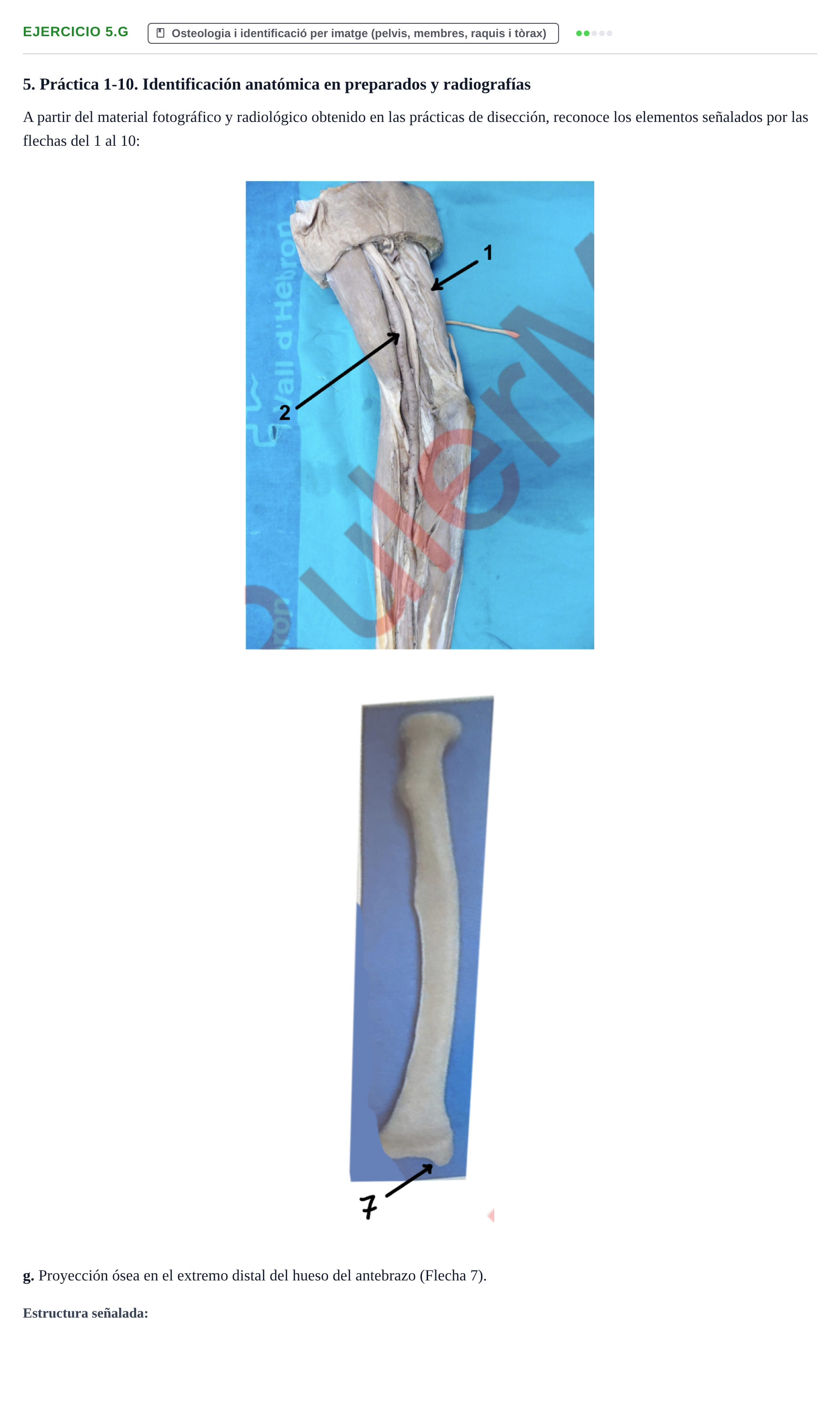 Enunciado: Ejercicio 5.g · Anatomia Humana: Generalitats i Aparell Locomotor UAB 2024