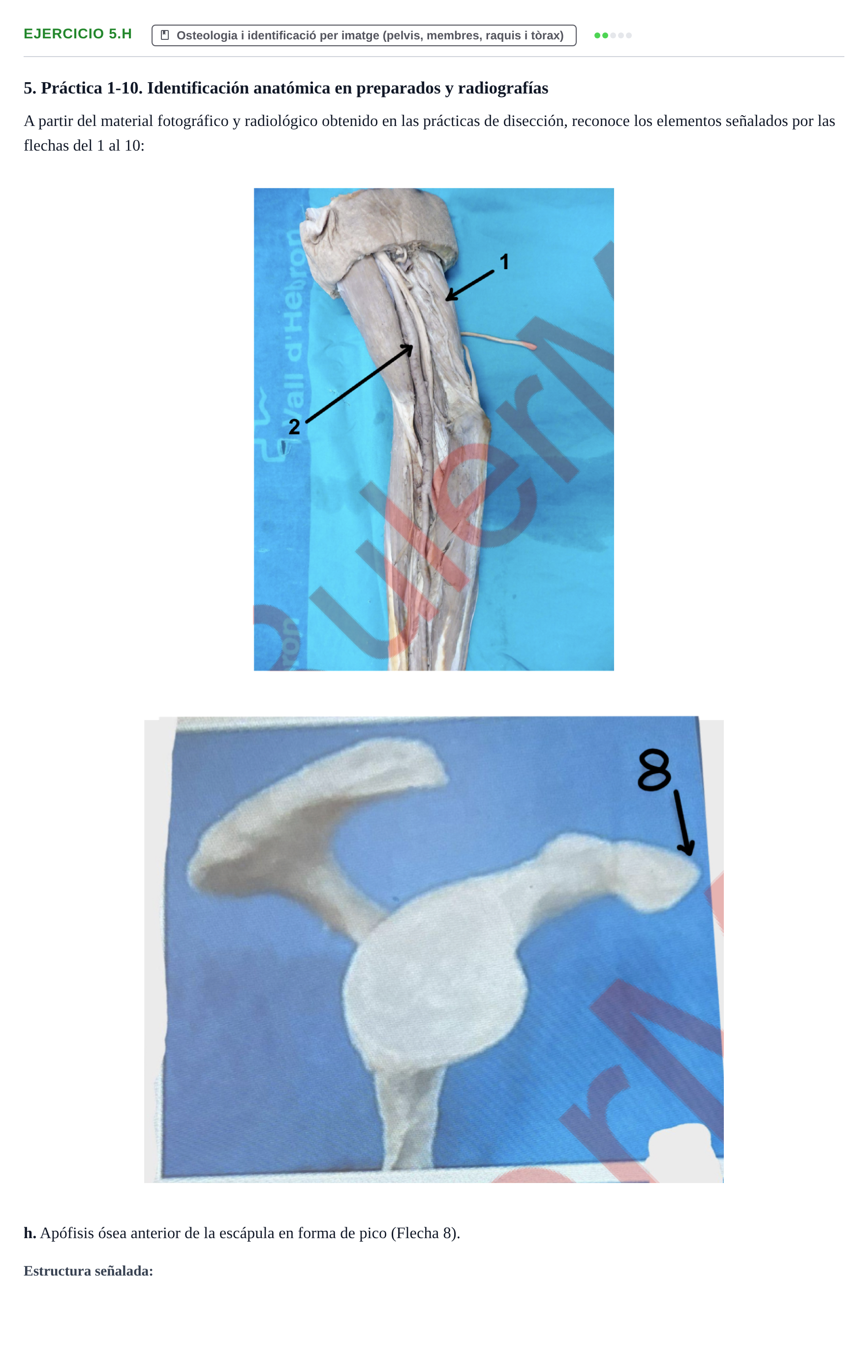 Enunciado: Ejercicio 5.h · Anatomia Humana: Generalitats i Aparell Locomotor UAB 2024