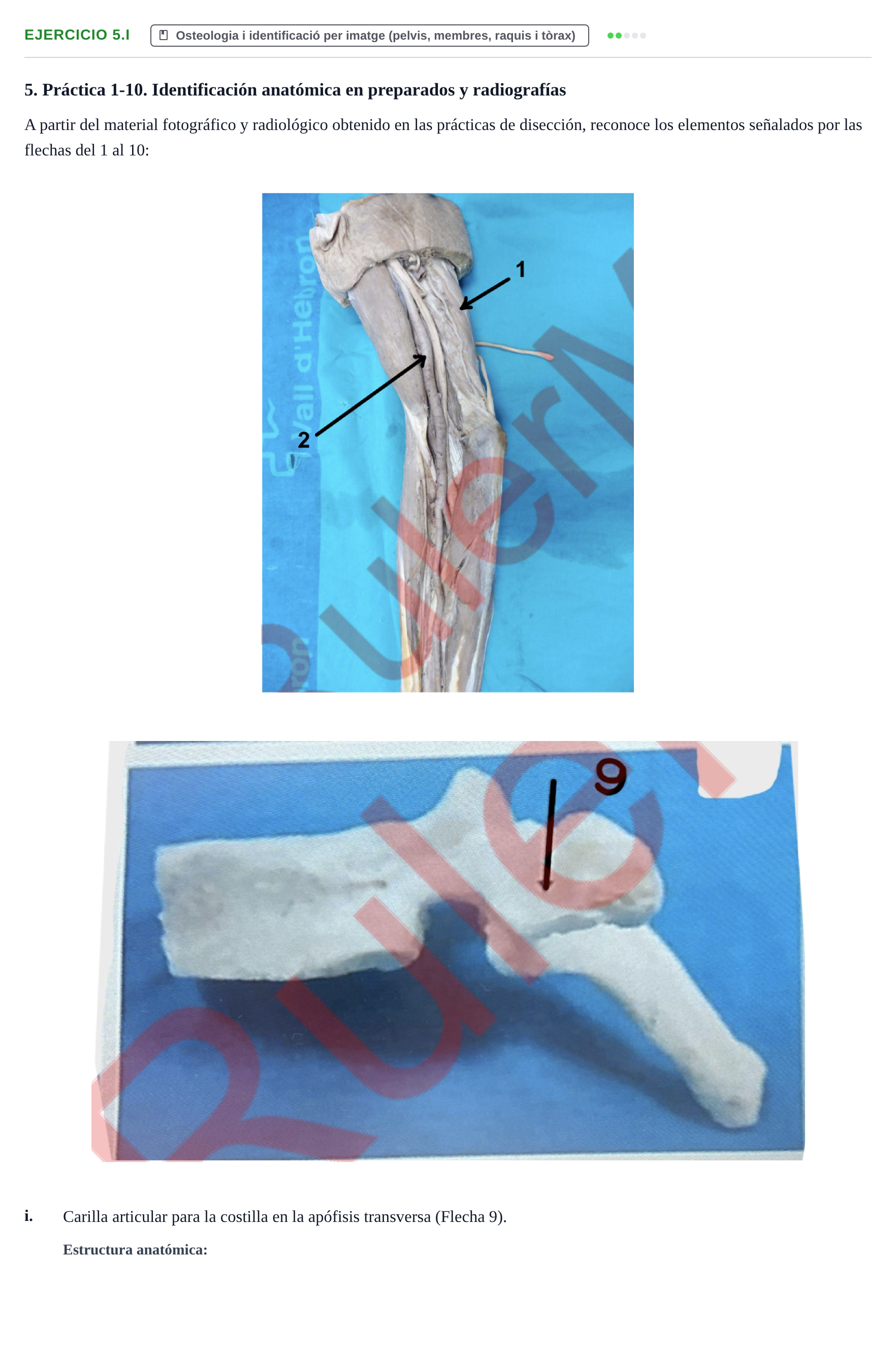 Enunciado: Ejercicio 5.i · Anatomia Humana: Generalitats i Aparell Locomotor UAB 2024