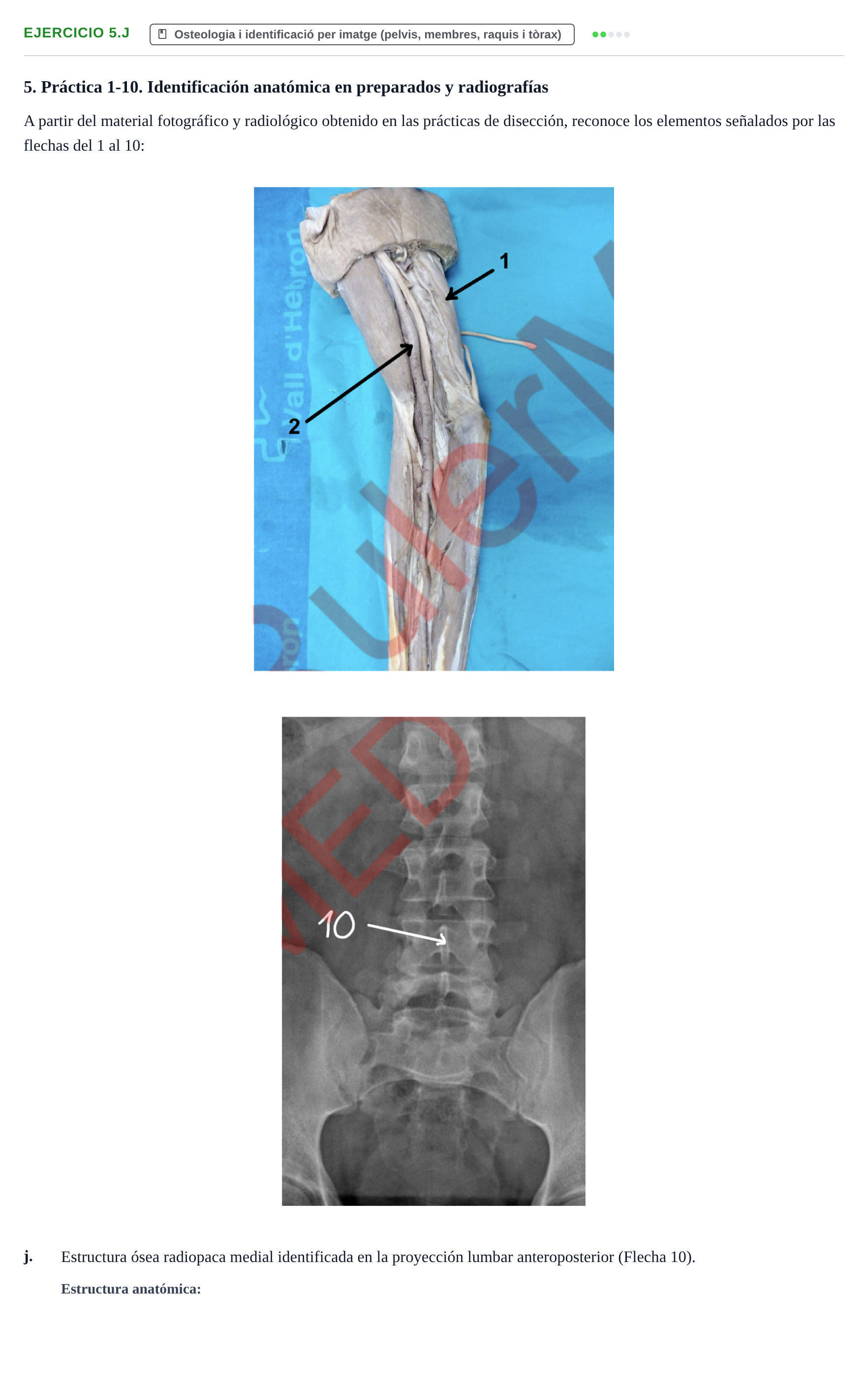 Enunciado: Ejercicio 5.j · Anatomia Humana: Generalitats i Aparell Locomotor UAB 2024