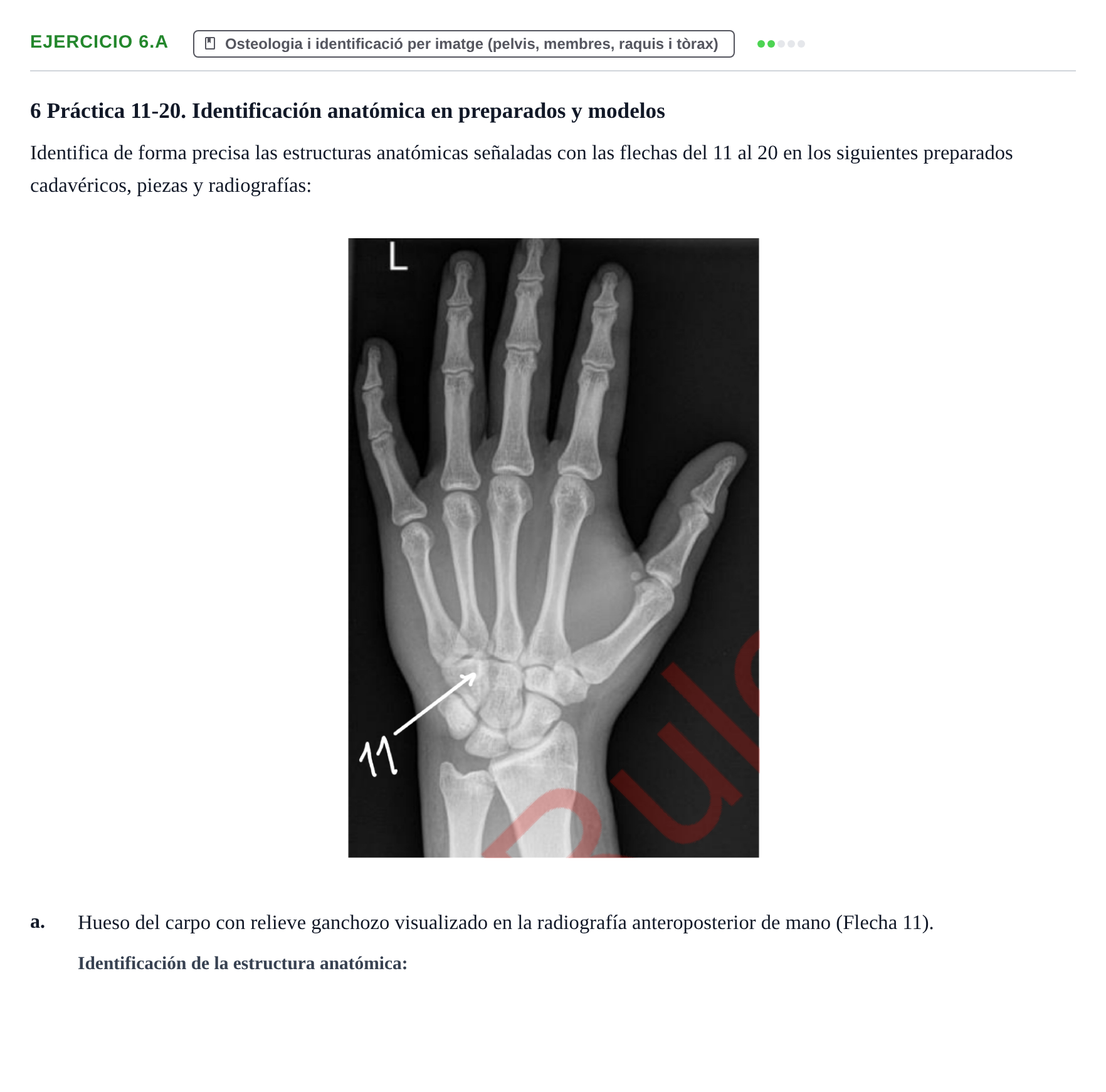 Enunciado: Ejercicio 6.a · Anatomia Humana: Generalitats i Aparell Locomotor UAB 2024