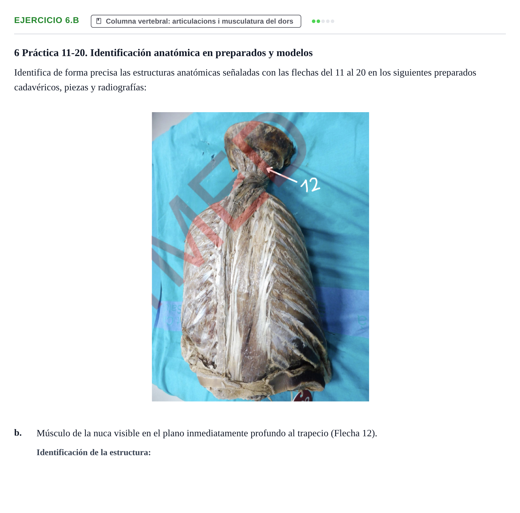 Enunciado: Ejercicio 6.b · Anatomia Humana: Generalitats i Aparell Locomotor UAB 2024