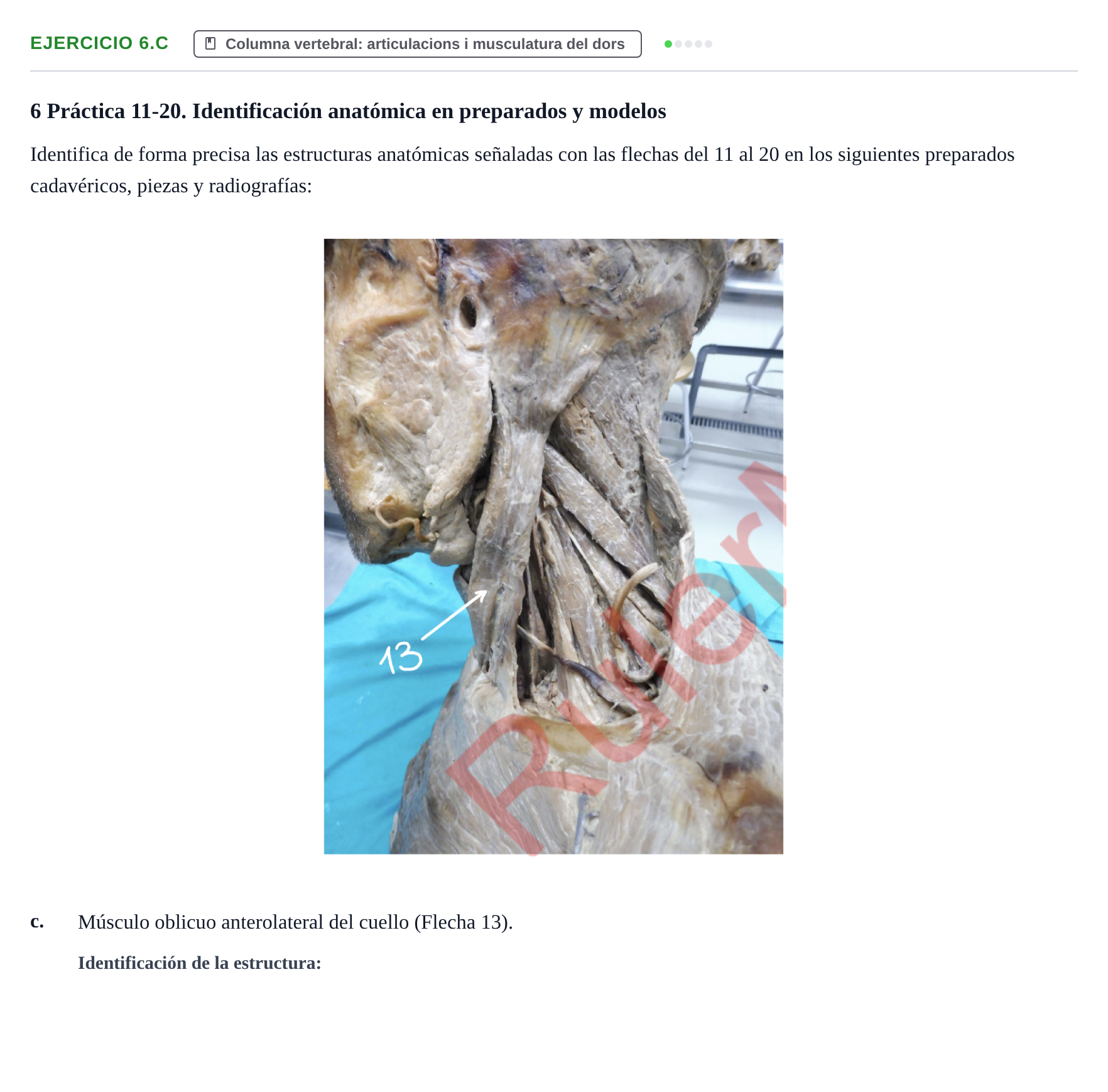 Enunciado: Ejercicio 6.c · Anatomia Humana: Generalitats i Aparell Locomotor UAB 2024