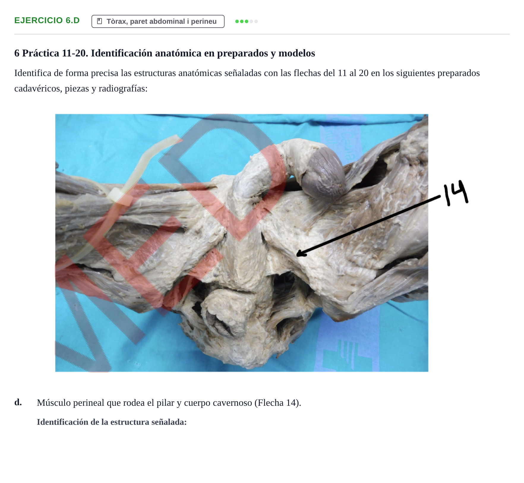 Enunciado: Ejercicio 6.d · Anatomia Humana: Generalitats i Aparell Locomotor UAB 2024