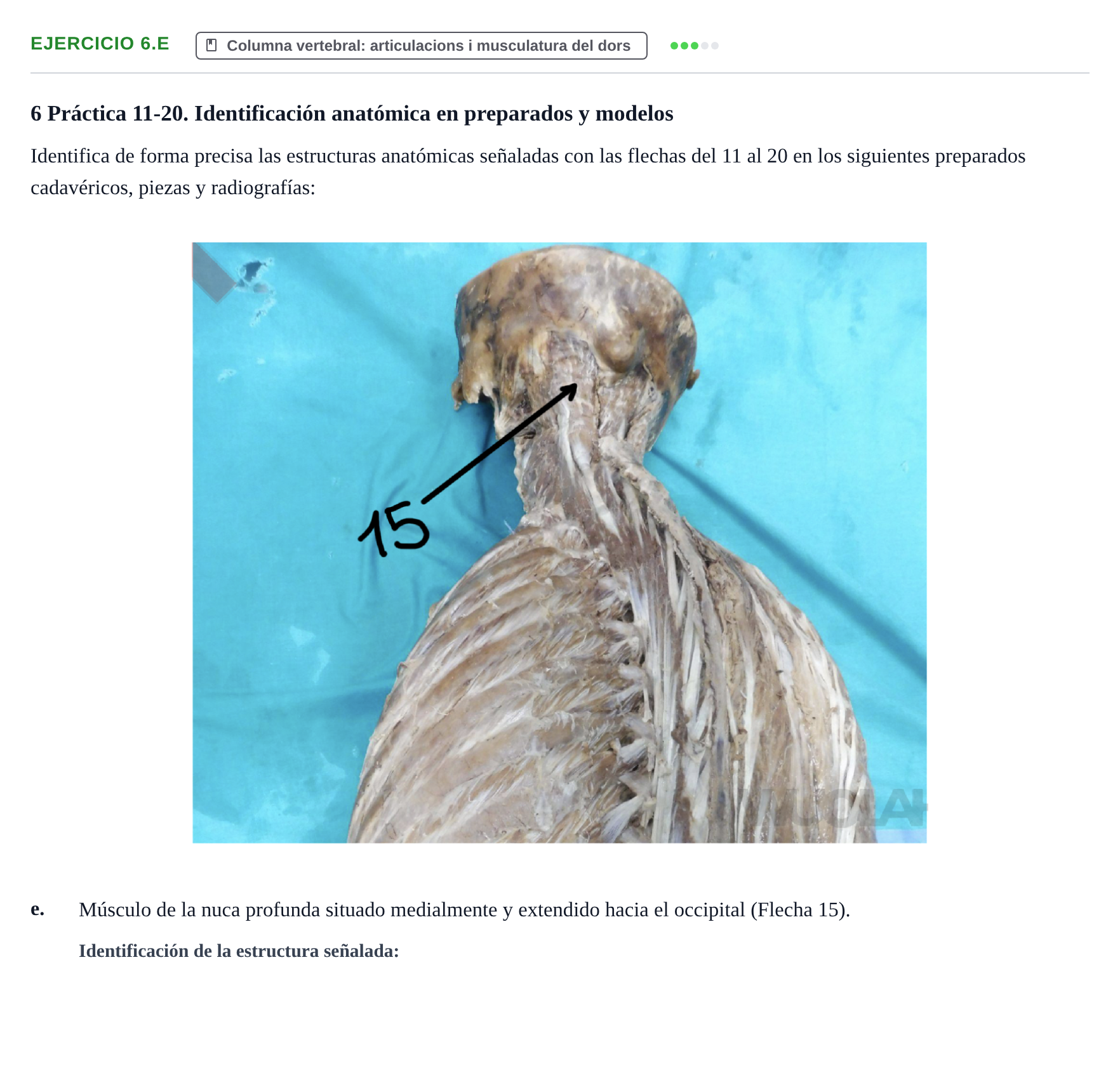 Enunciado: Ejercicio 6.e · Anatomia Humana: Generalitats i Aparell Locomotor UAB 2024