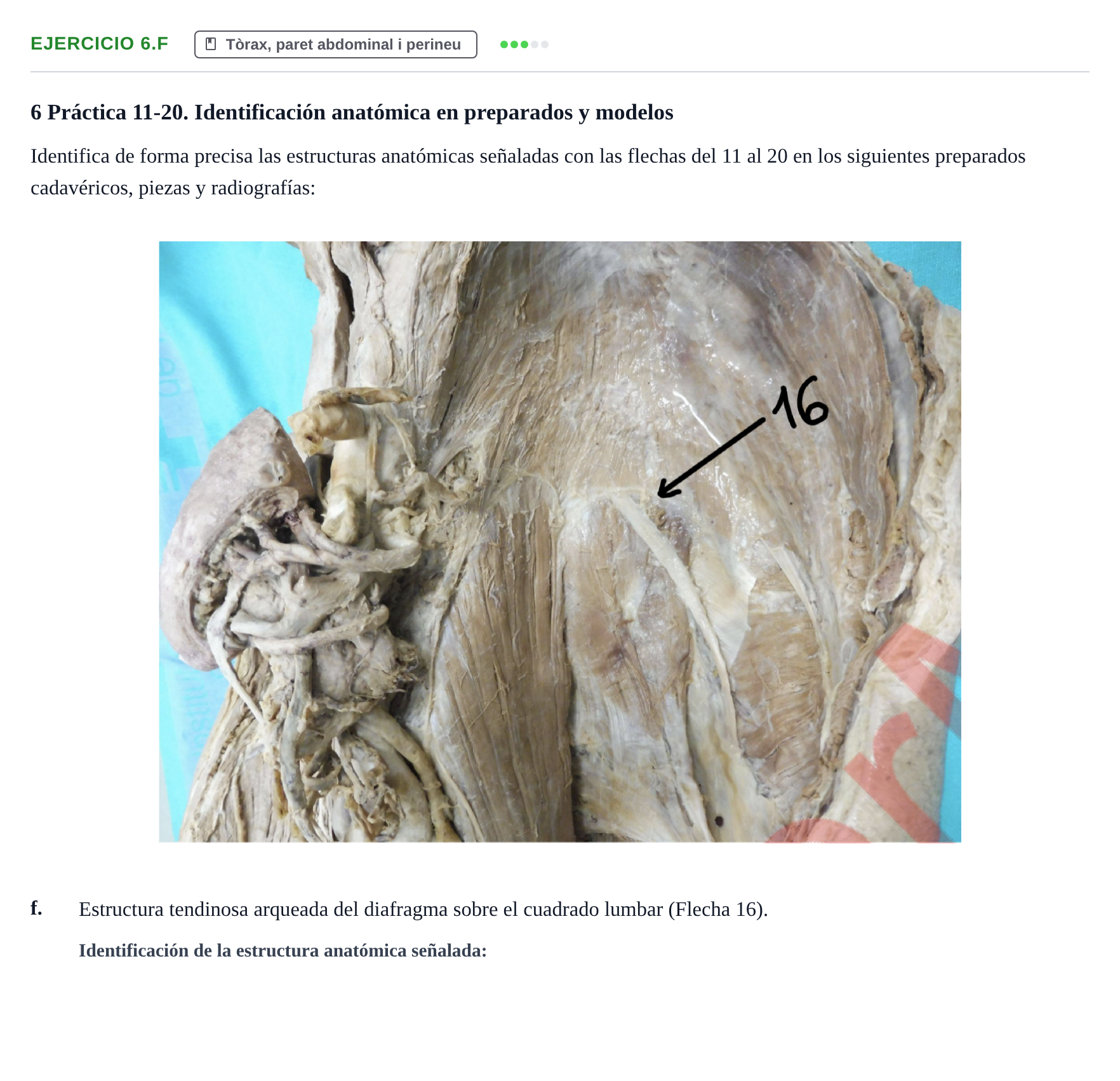 Enunciado: Ejercicio 6.f · Anatomia Humana: Generalitats i Aparell Locomotor UAB 2024