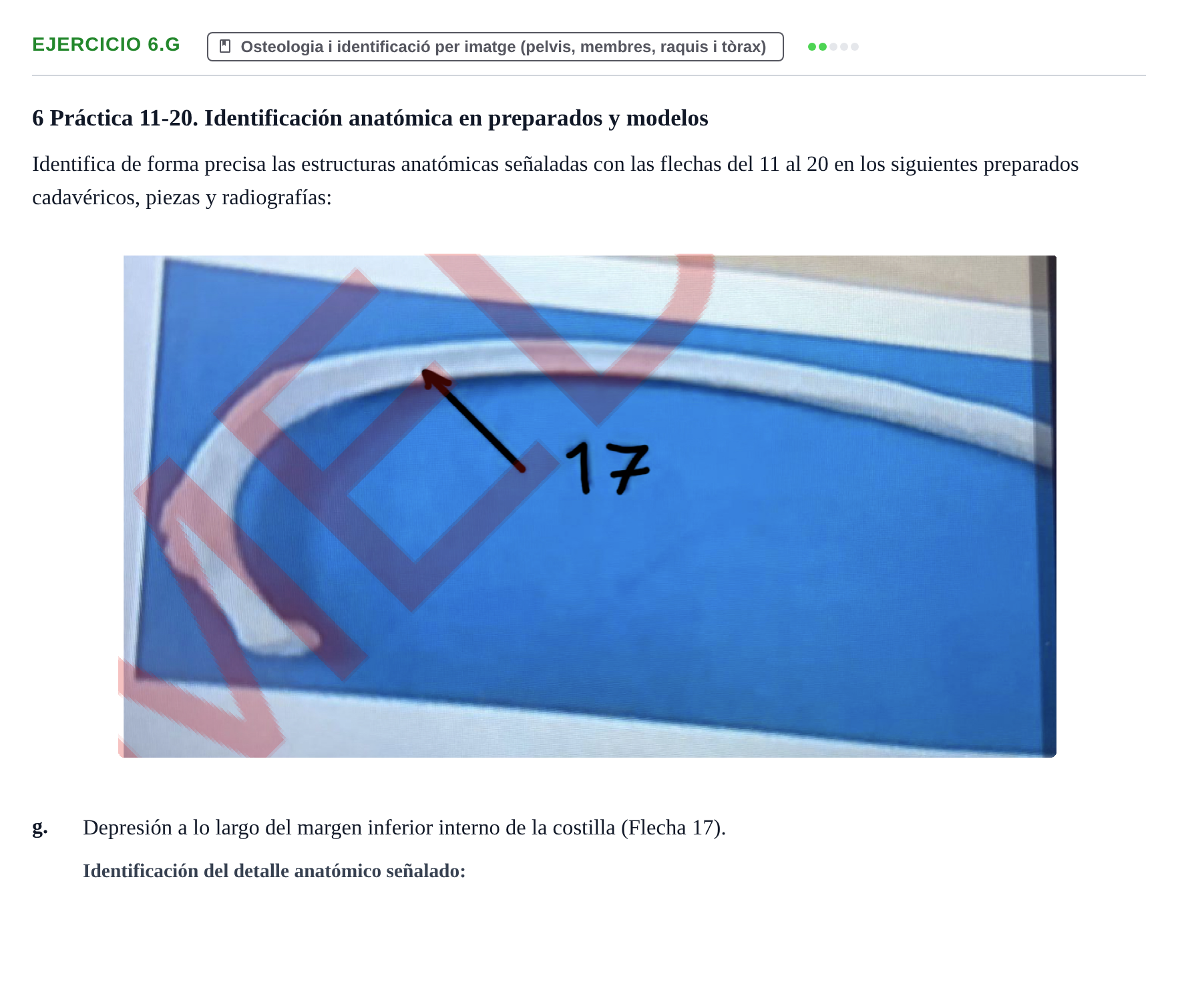 Enunciado: Ejercicio 6.g · Anatomia Humana: Generalitats i Aparell Locomotor UAB 2024