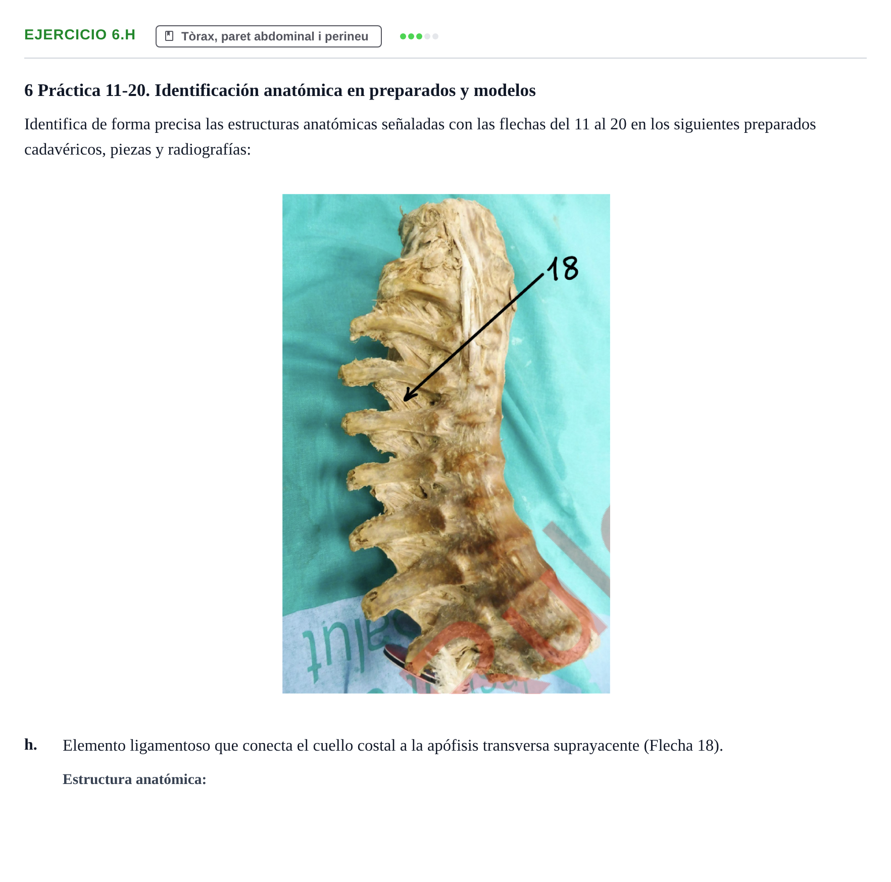 Enunciado: Ejercicio 6.h · Anatomia Humana: Generalitats i Aparell Locomotor UAB 2024
