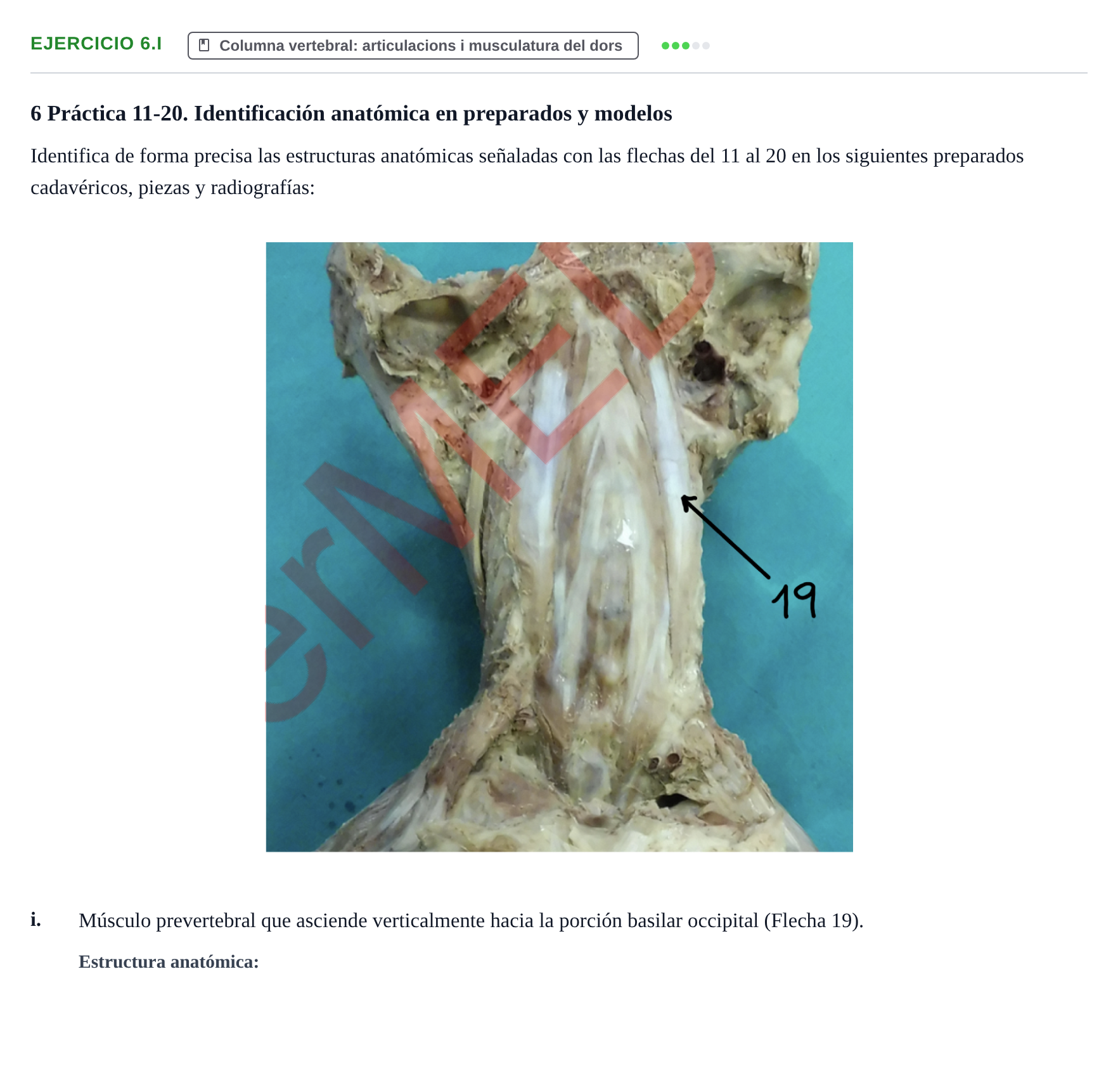 Enunciado: Ejercicio 6.i · Anatomia Humana: Generalitats i Aparell Locomotor UAB 2024