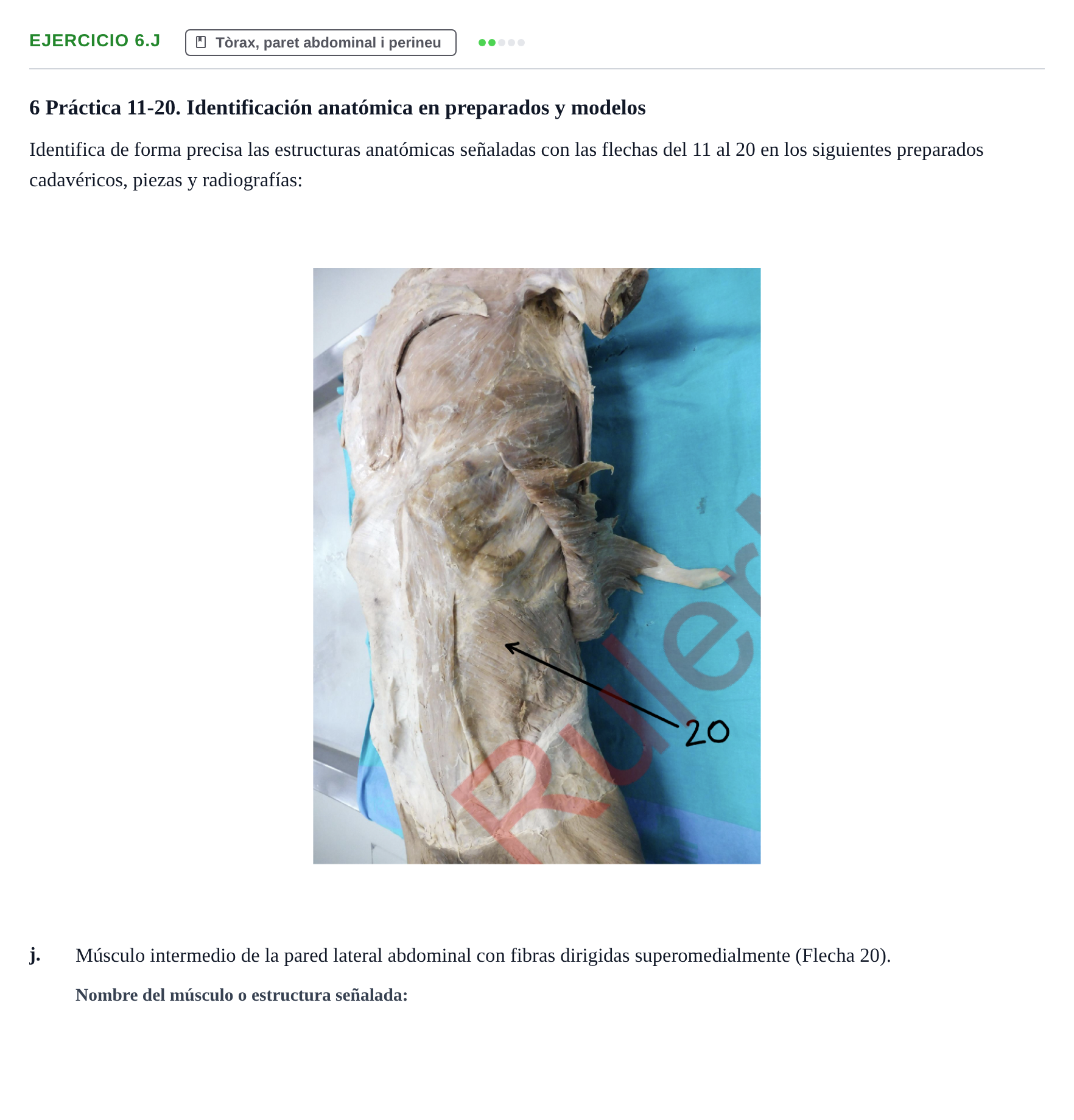 Enunciado: Ejercicio 6.j · Anatomia Humana: Generalitats i Aparell Locomotor UAB 2024