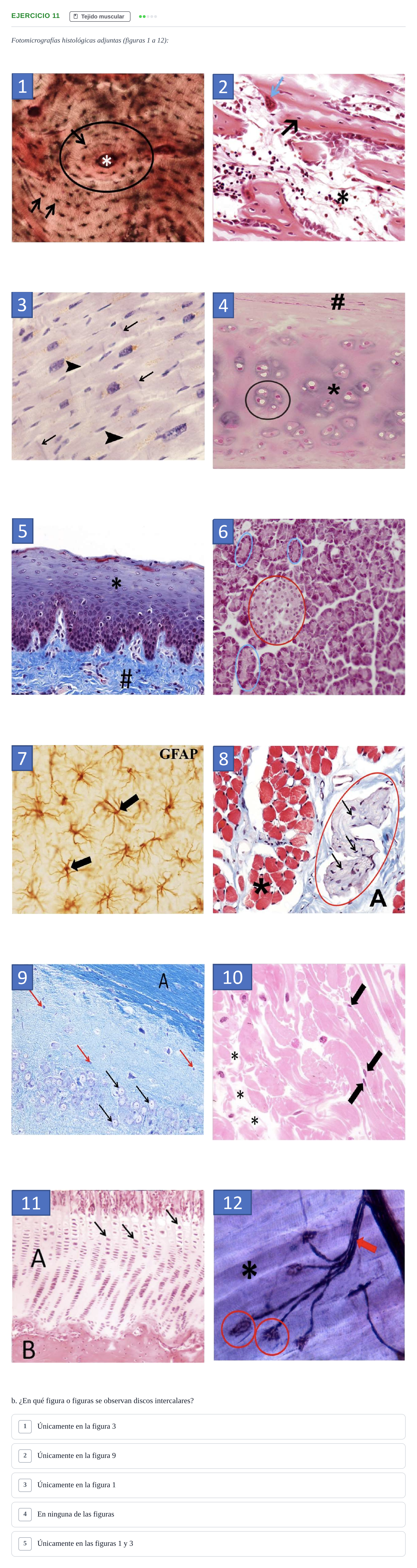 Enunciado: Ejercicio 11 - Tejido muscular · Histología UAB Examen parcial de Histología Médica (Permutación 1)