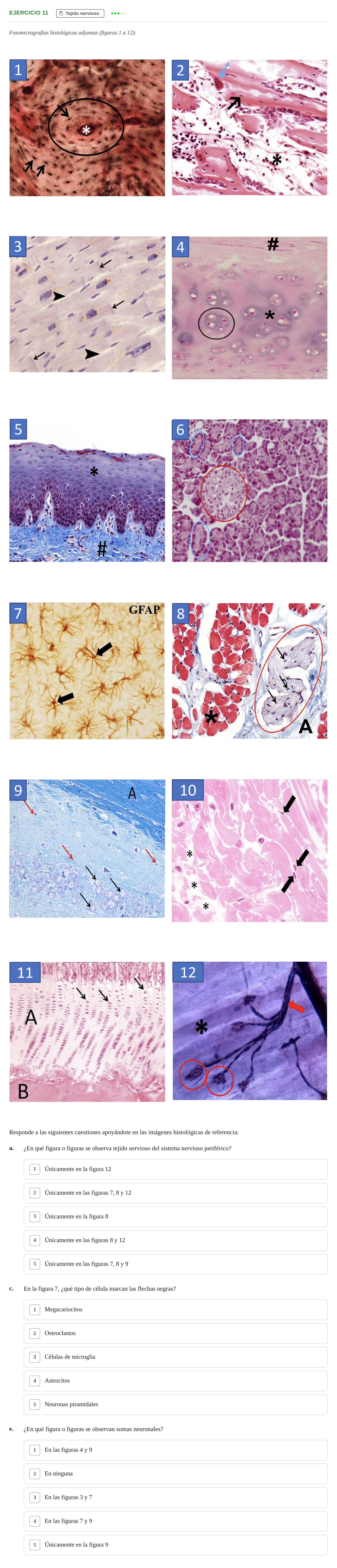 Enunciado: Ejercicio 11 - Tejido nervioso · Histología UAB Examen parcial de Histología Médica (Permutación 1)