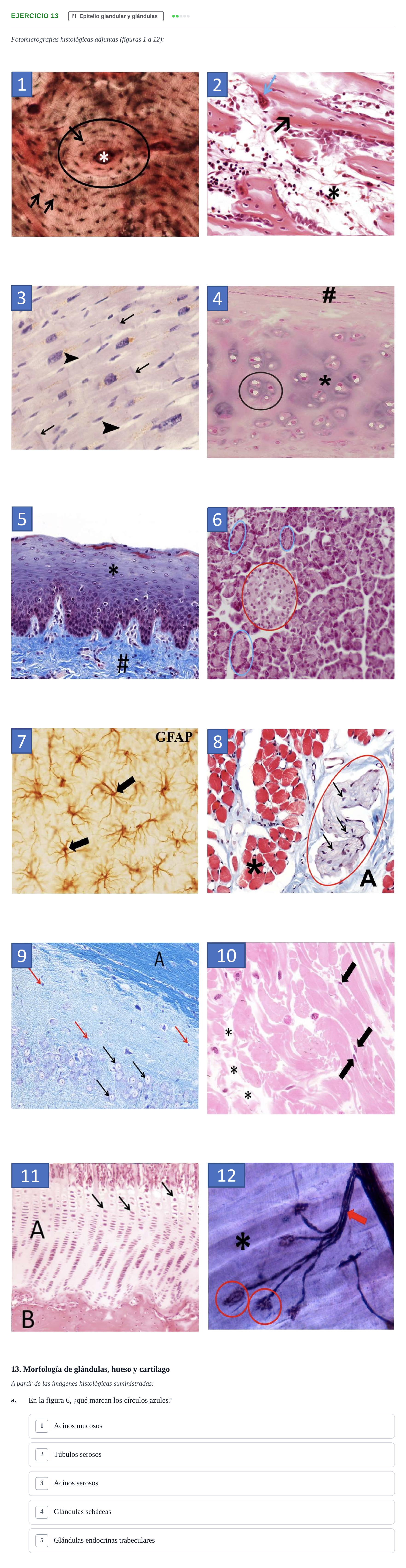 Enunciado: Ejercicio 13 - Epitelio glandular y glándulas · Histología UAB Examen parcial de Histología Médica (Permutación 1)
