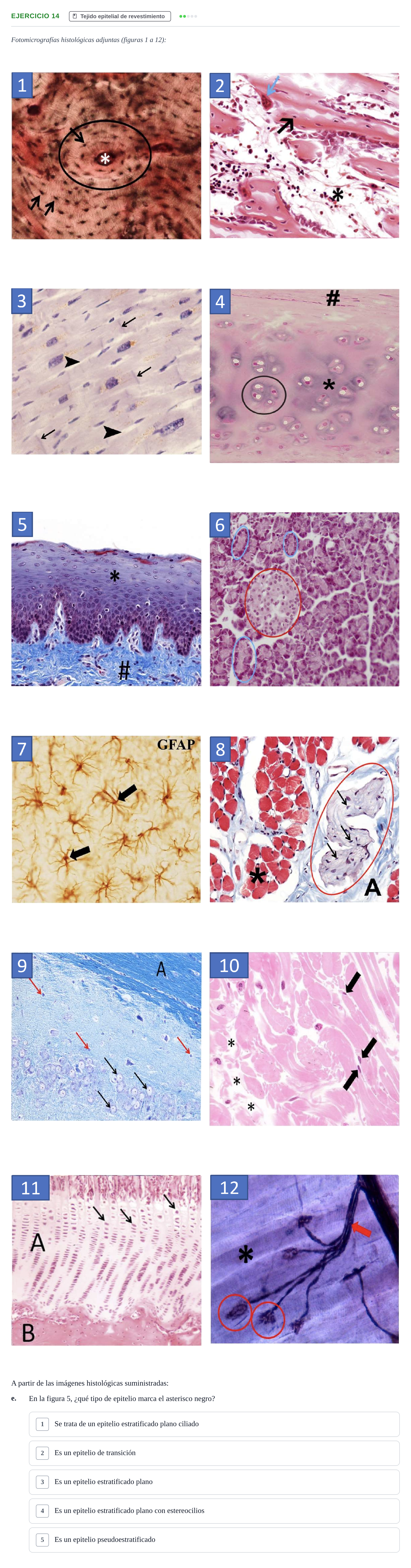 Enunciado: Ejercicio 14 - Tejido epitelial de revestimiento · Histología UAB Examen parcial de Histología Médica (Permutación 1)