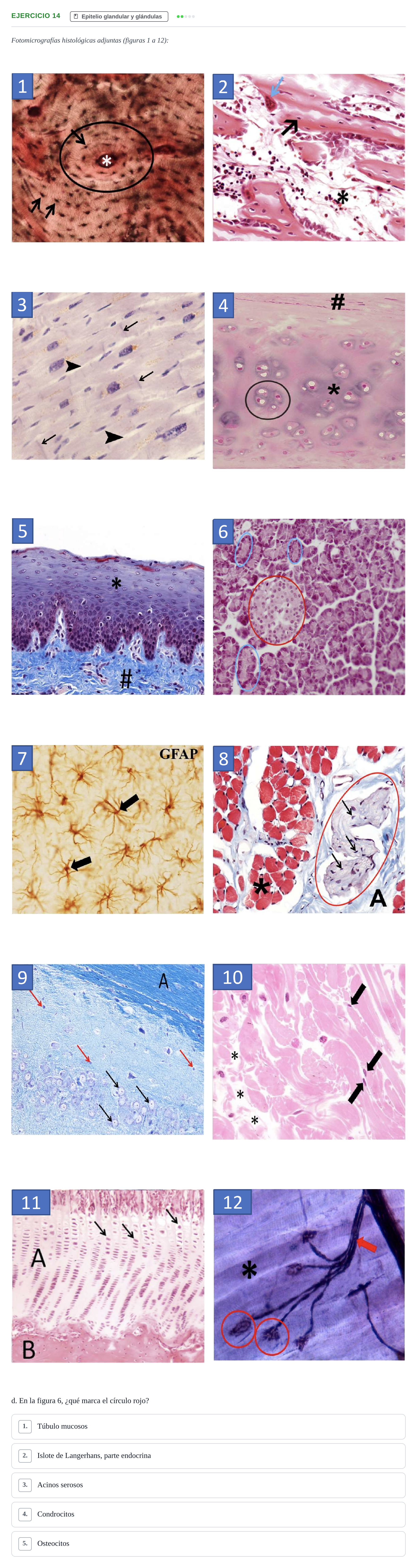 Enunciado: Ejercicio 14 - Epitelio glandular y glándulas · Histología UAB Examen parcial de Histología Médica (Permutación 1)