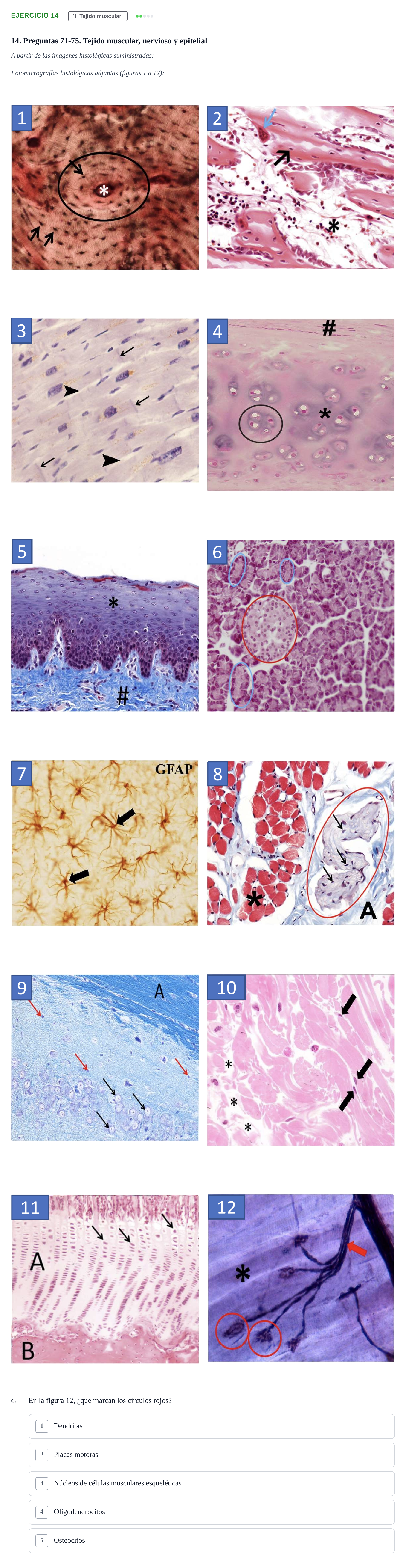 Enunciado: Ejercicio 14 - Tejido muscular · Histología UAB Examen parcial de Histología Médica (Permutación 1)