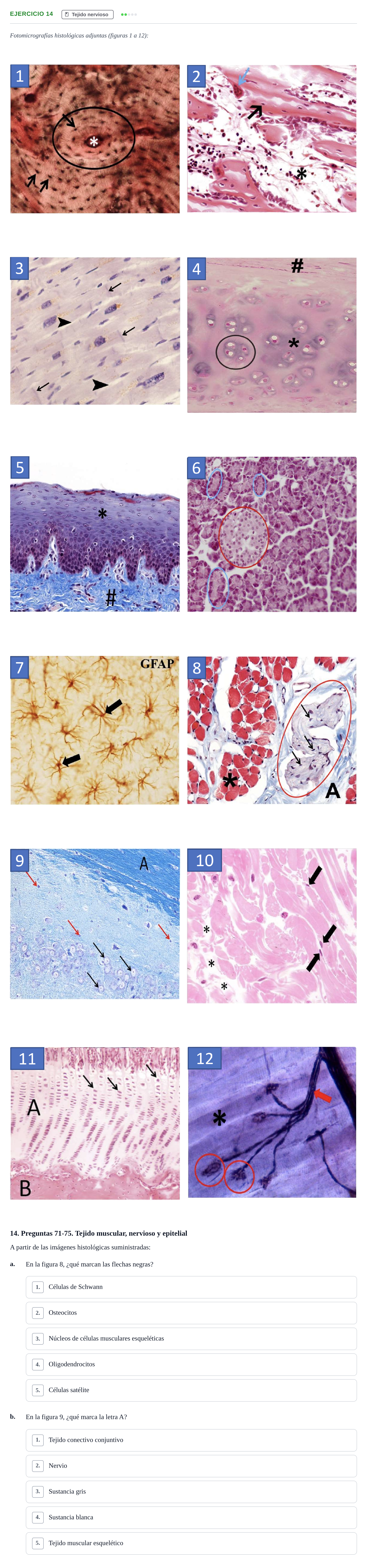 Enunciado: Ejercicio 14 - Tejido nervioso · Histología UAB Examen parcial de Histología Médica (Permutación 1)
