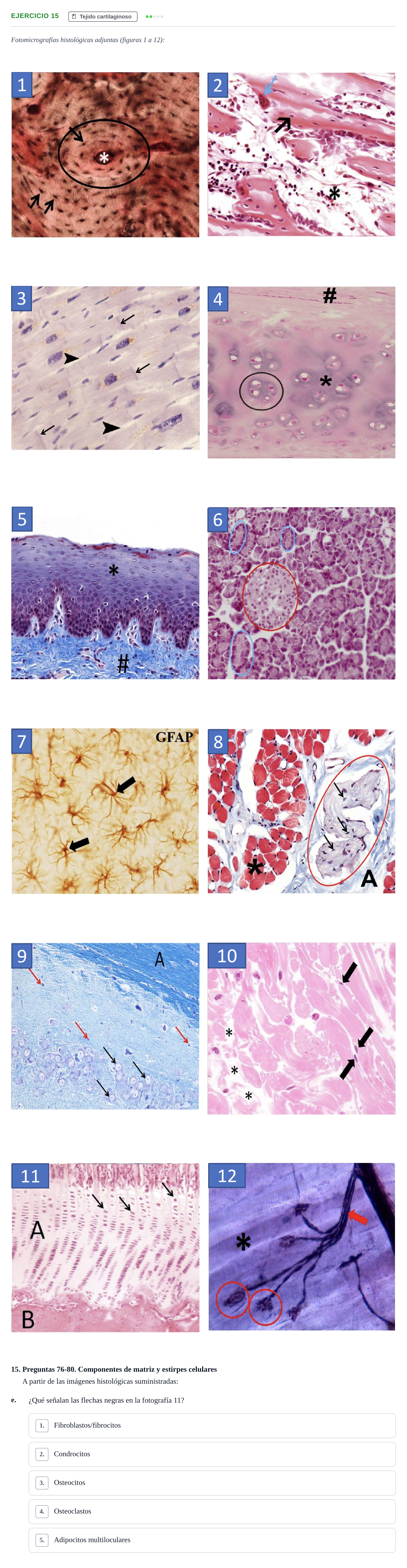 Enunciado: Ejercicio 15 - Tejido cartilaginoso · Histología UAB Examen parcial de Histología Médica (Permutación 1)