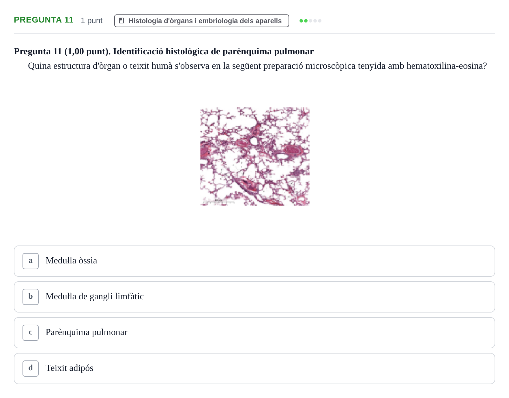 Enunciado: Pregunta 11 · Estructura i Funció del Cos Humà II UVIC Examen primer parcial: Estructura i Funció del Cos Humà II