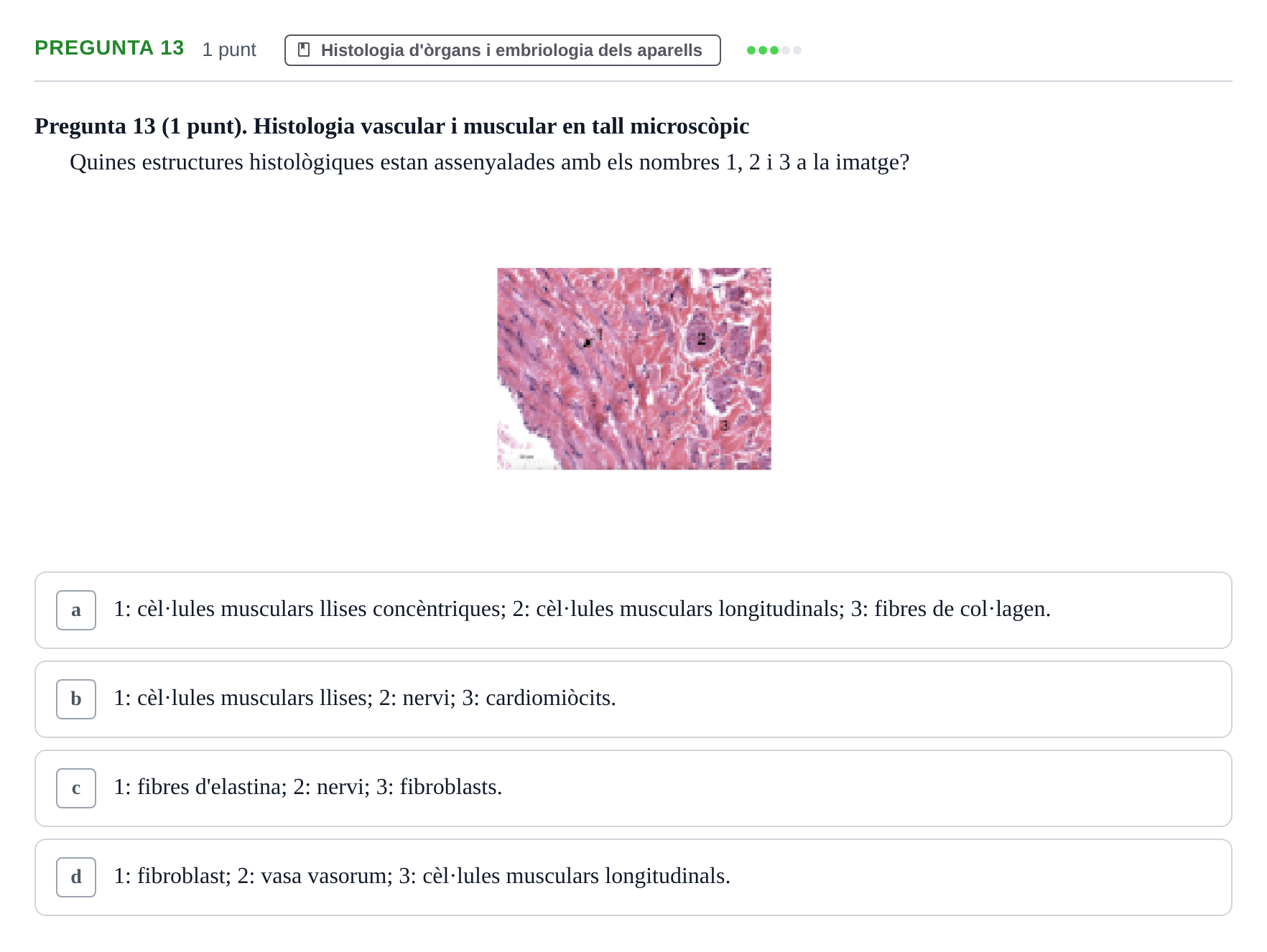 Enunciado: Pregunta 13 · Estructura i Funció del Cos Humà II UVIC Examen de síntesi: Estructura i Funció del Cos Humà II