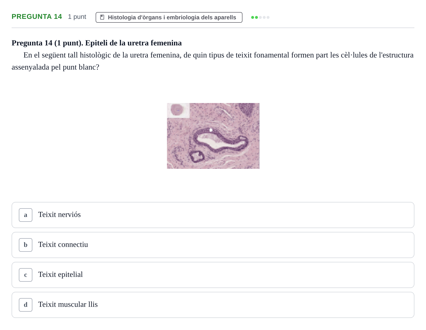 Enunciado: Pregunta 14 · Estructura i Funció del Cos Humà II UVIC Examen de síntesi: Estructura i Funció del Cos Humà II