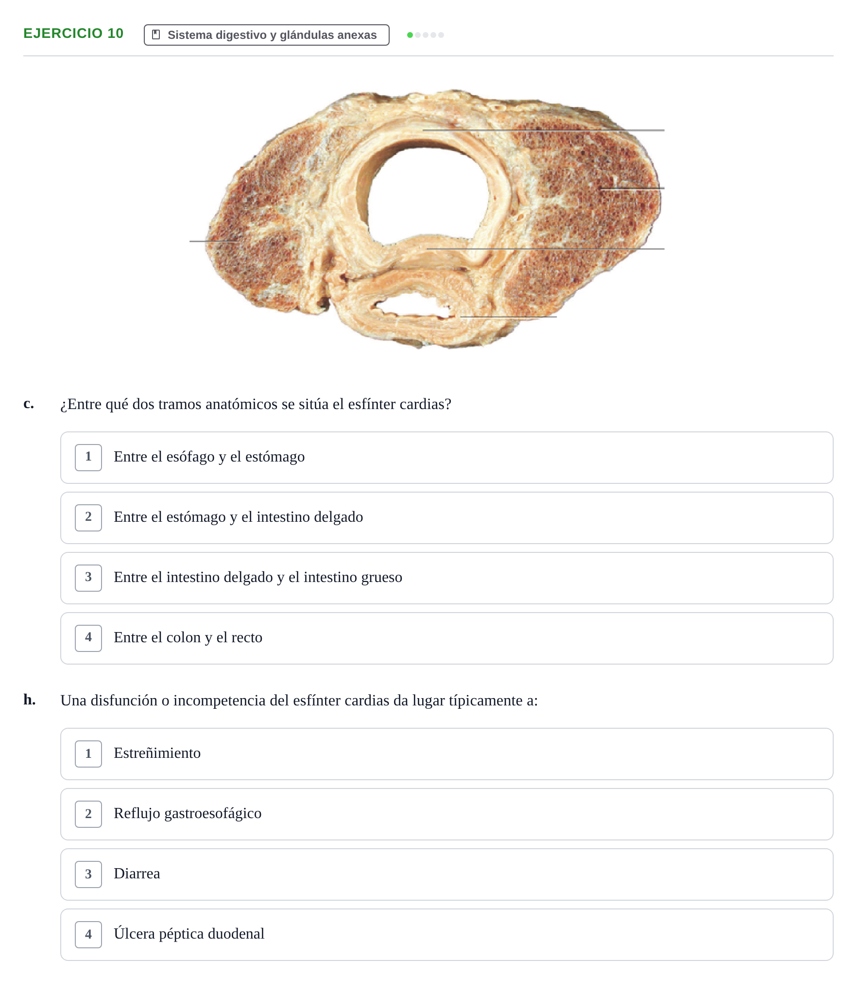Enunciado: Ejercicio 10 - Sistema digestivo · BASES BIOLÒGIQUES PER L'ATENCIO A LA PERSONA: ANATOMIA UDL 2023