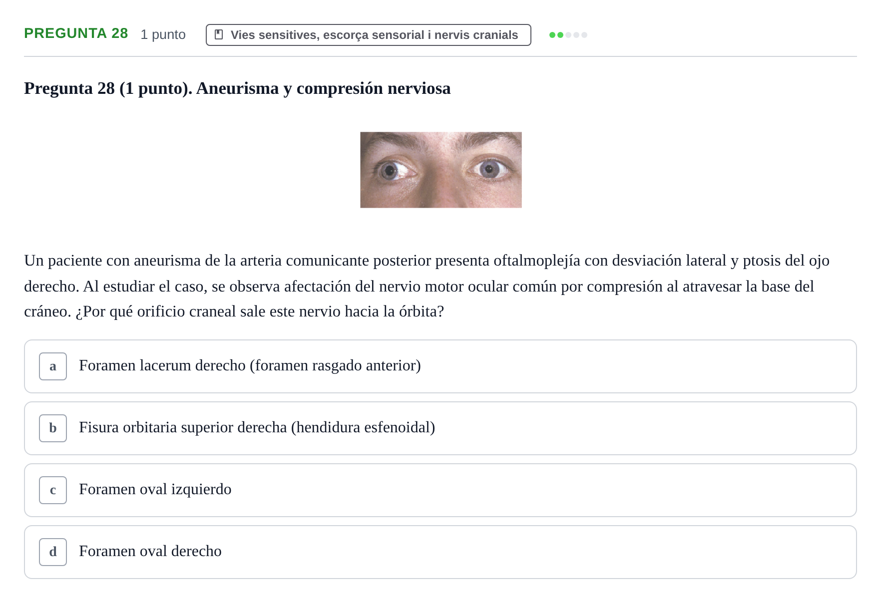 Enunciado: Pregunta 28 · Estructura i Funció del Cos Humà III UVIC Examen Parcial 1. Neuroanatomía y Fisiología del Sistema Nervioso