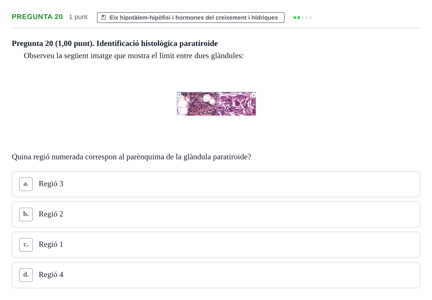 Enunciado: Pregunta 20 · Estructura i Funció del Cos Humà III UVIC Examen Parcial 2. Estructura i Funció del Cos Humà III
