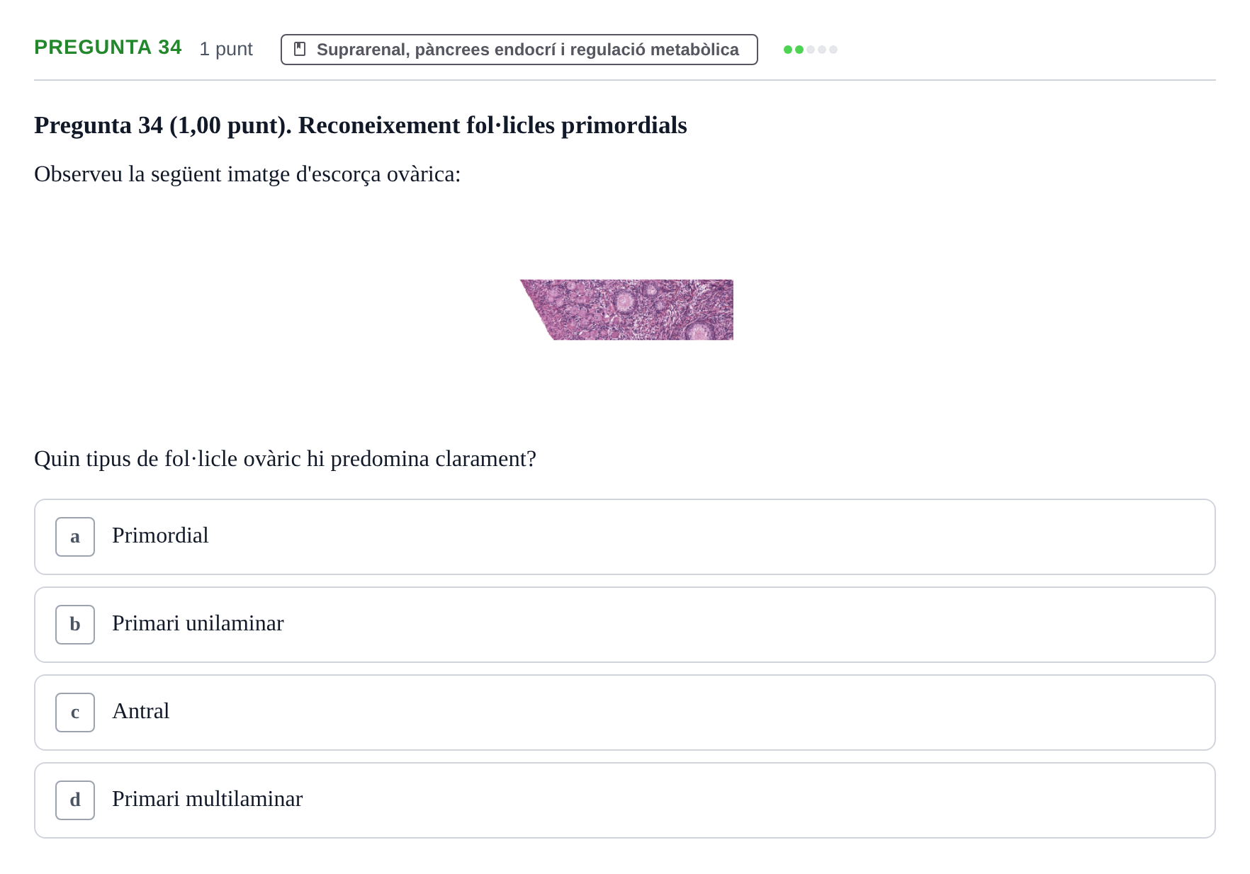 Enunciado: Pregunta 34 · Estructura i Funció del Cos Humà III UVIC Examen Parcial 2. Estructura i Funció del Cos Humà III