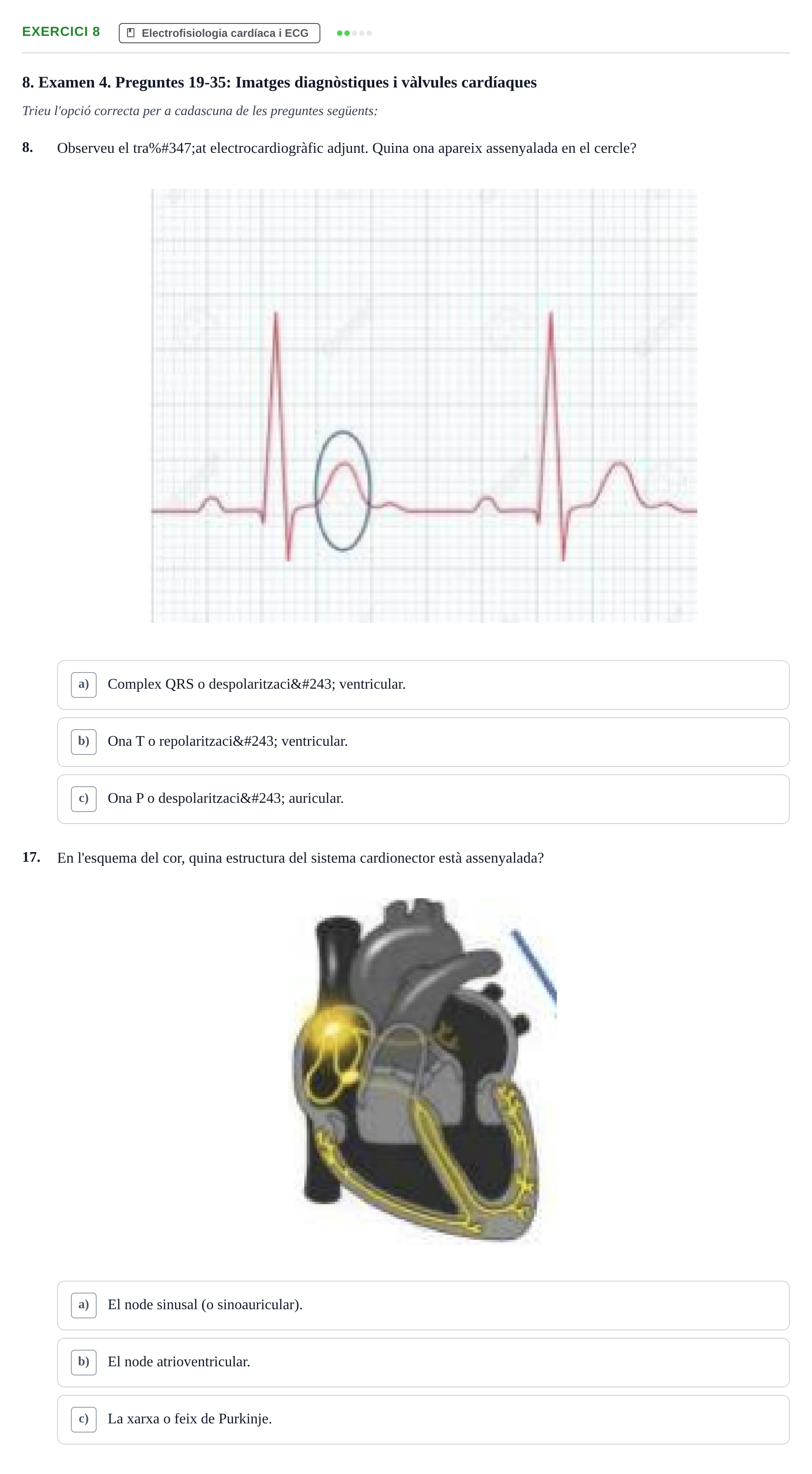 Enunciado: Ejercicio 8 - Electrofisiologia cardíaca i ECG · Anatomofisiología 2 URL Avaluació Parcial: Aparell Cardiovascular, Sang i Sistema Limfàtic