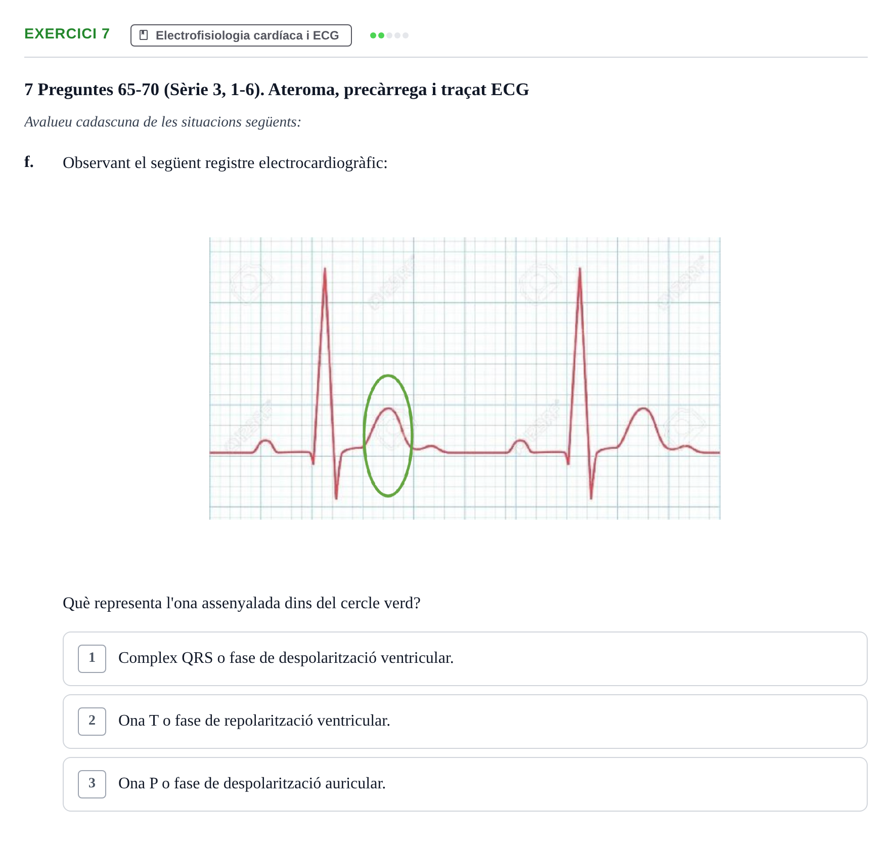Enunciado: Ejercicio 7 - Electrofisiologia cardíaca i ECG · Anatomofisiología 2 URL Examen 2n Semestre: Sistema Cardiovascular i Immunitari
