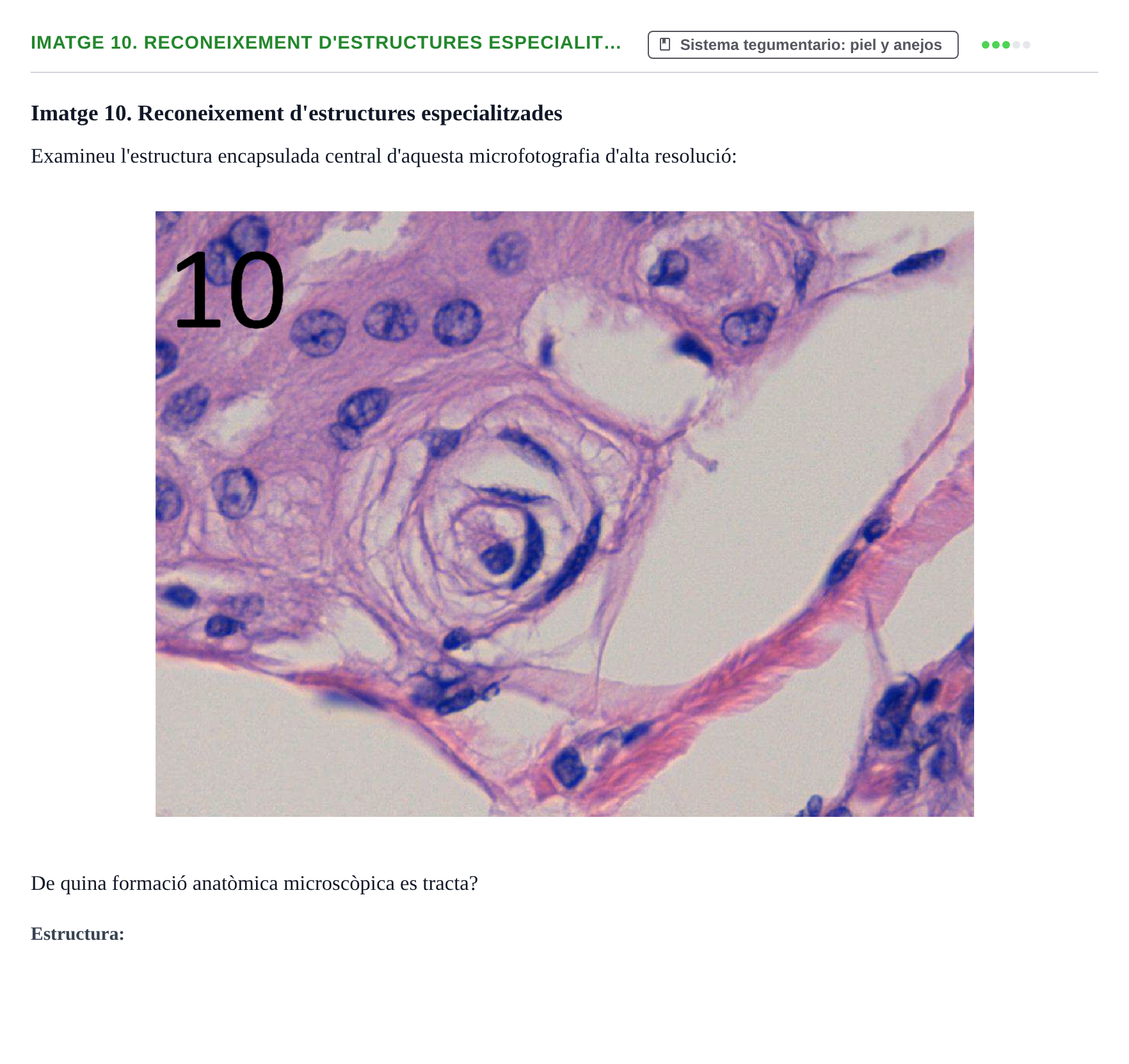 Enunciado: Ejercicio Imatge 10. Reconeixement d'estructures especialit… · Anatomia Microscòpica UDL 2015