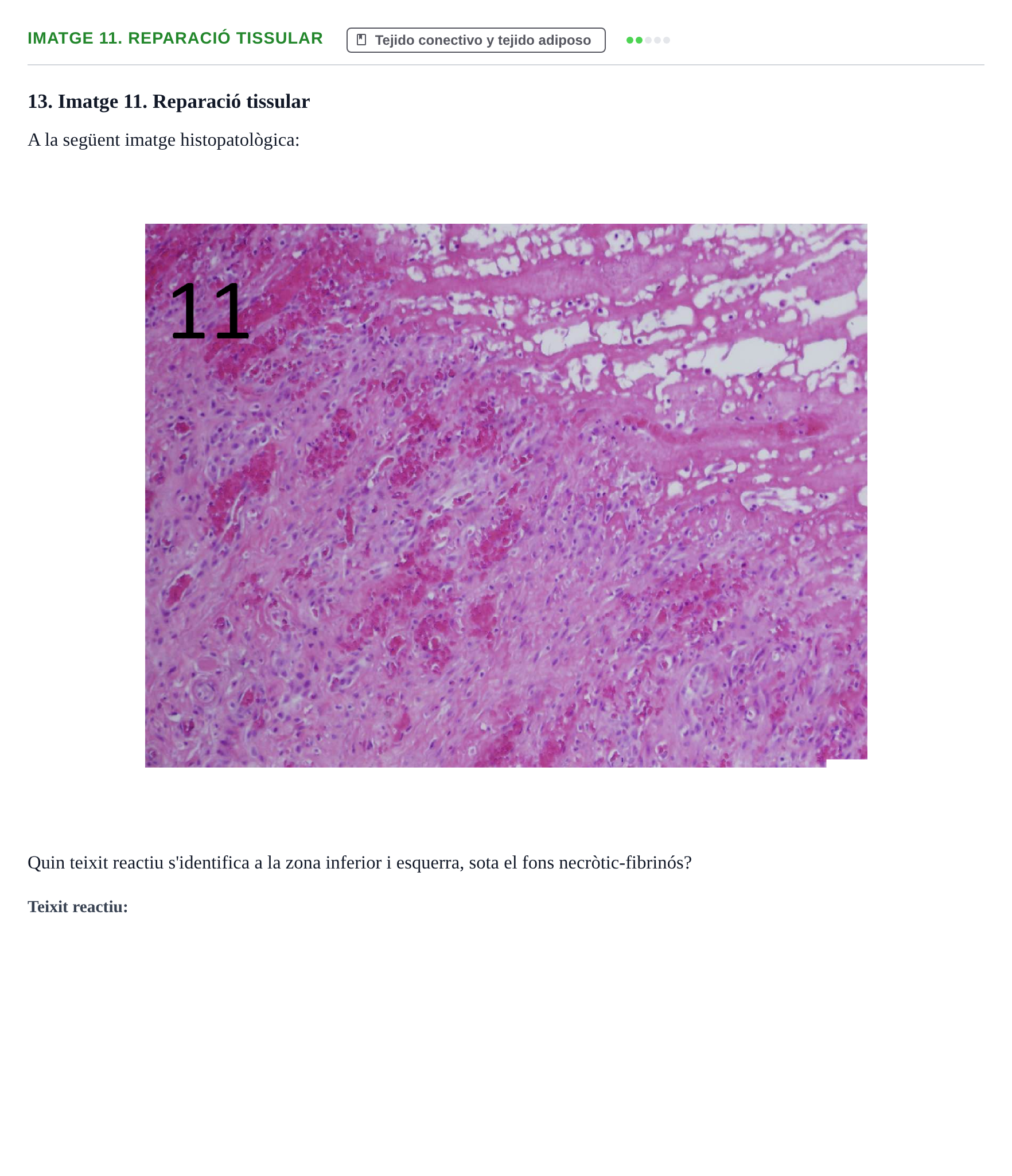 Enunciado: Ejercicio Imatge 11. Reparació tissular · Anatomia Microscòpica UDL 2015