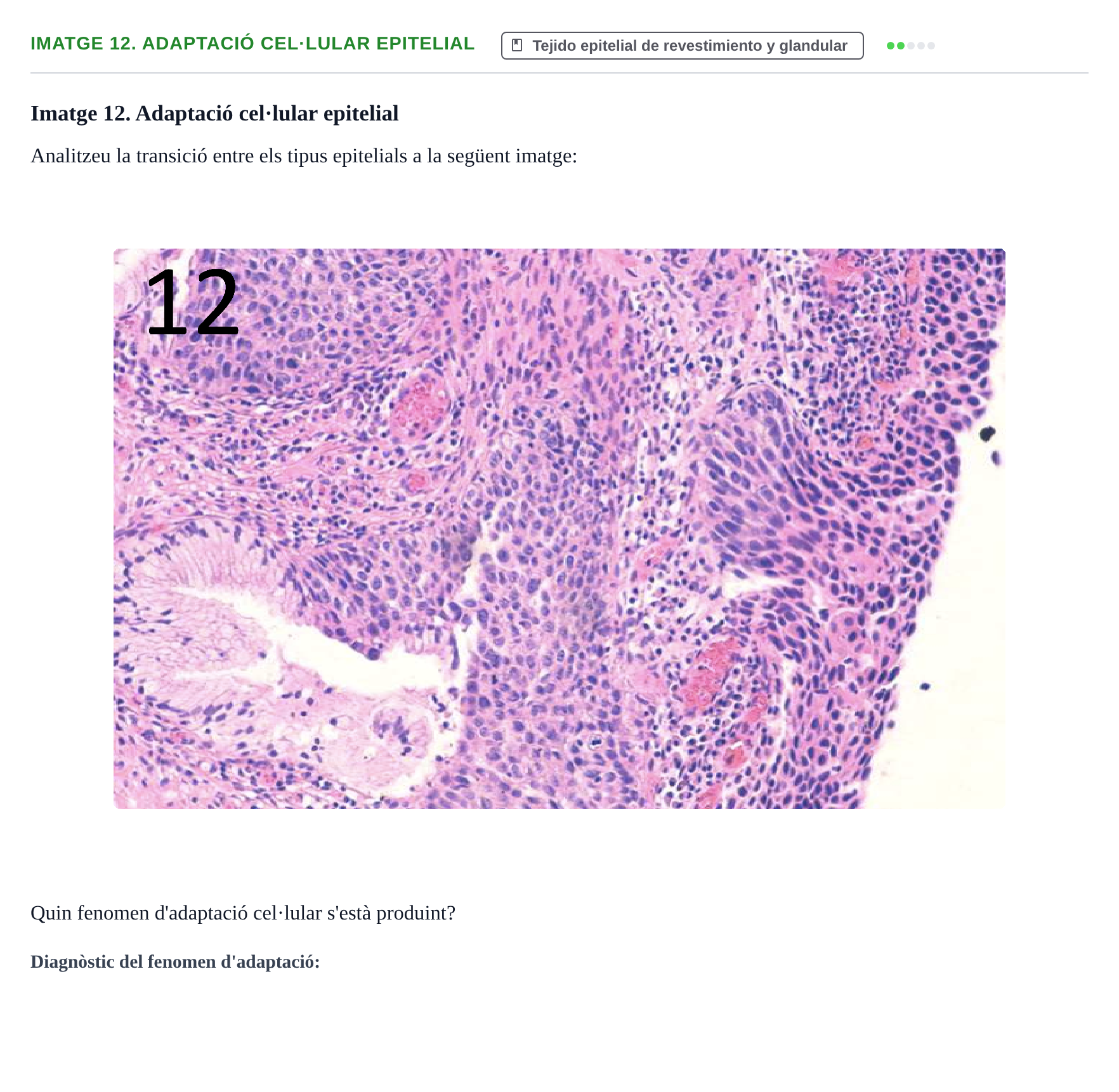 Enunciado: Ejercicio Imatge 12. Adaptació cel·lular epitelial · Anatomia Microscòpica UDL 2015