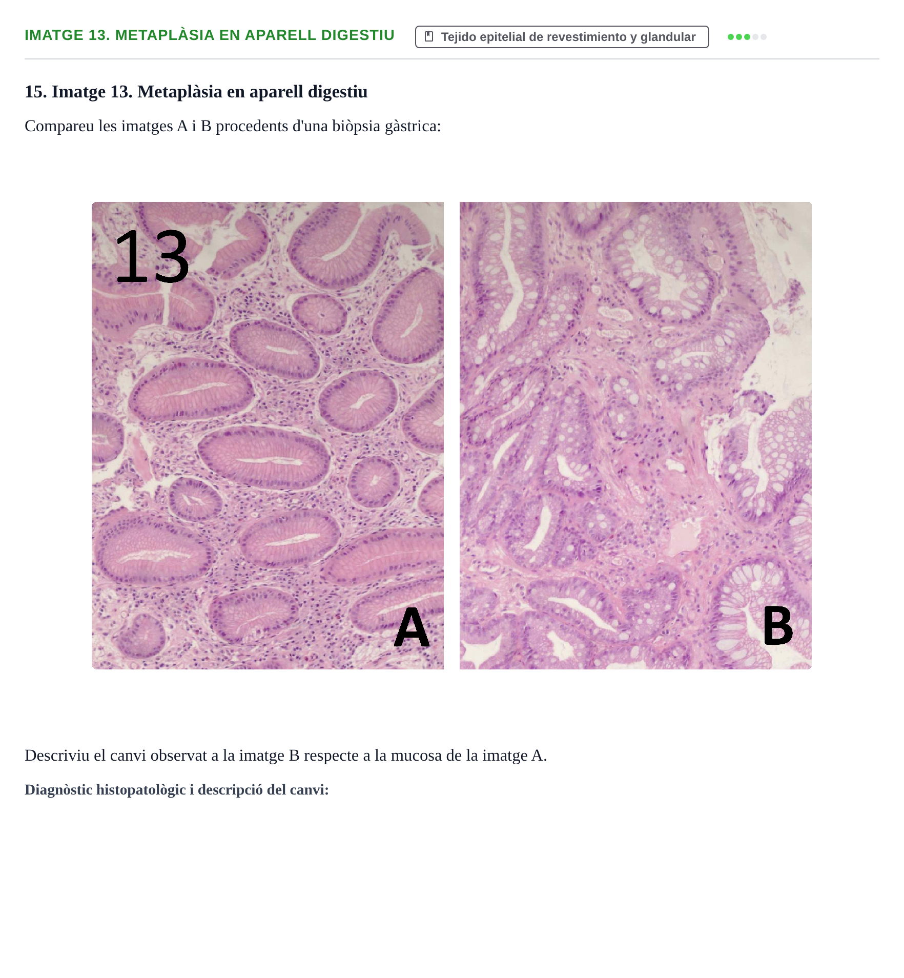 Enunciado: Ejercicio Imatge 13. Metaplàsia en aparell digestiu · Anatomia Microscòpica UDL 2015