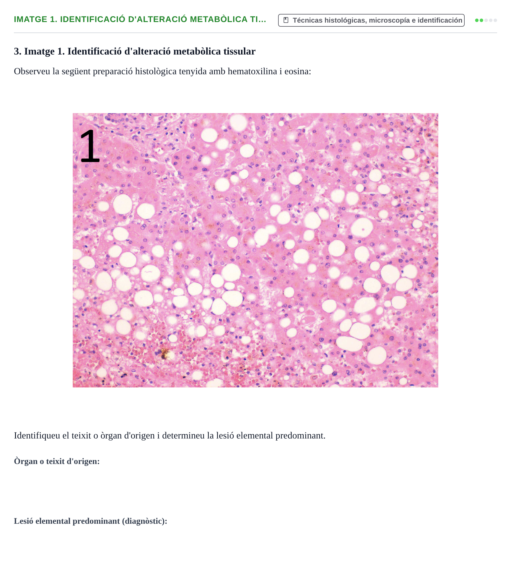 Enunciado: Ejercicio Imatge 1. Identificació d'alteració metabòlica ti… · Anatomia Microscòpica UDL 2015