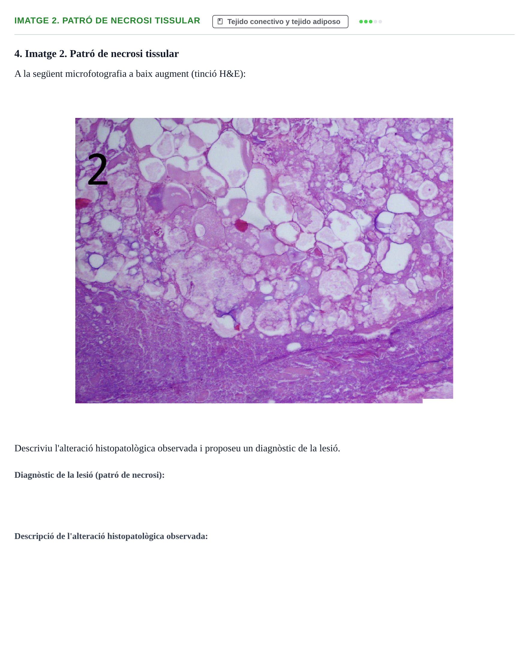 Enunciado: Ejercicio Imatge 2. Patró de necrosi tissular · Anatomia Microscòpica UDL 2015