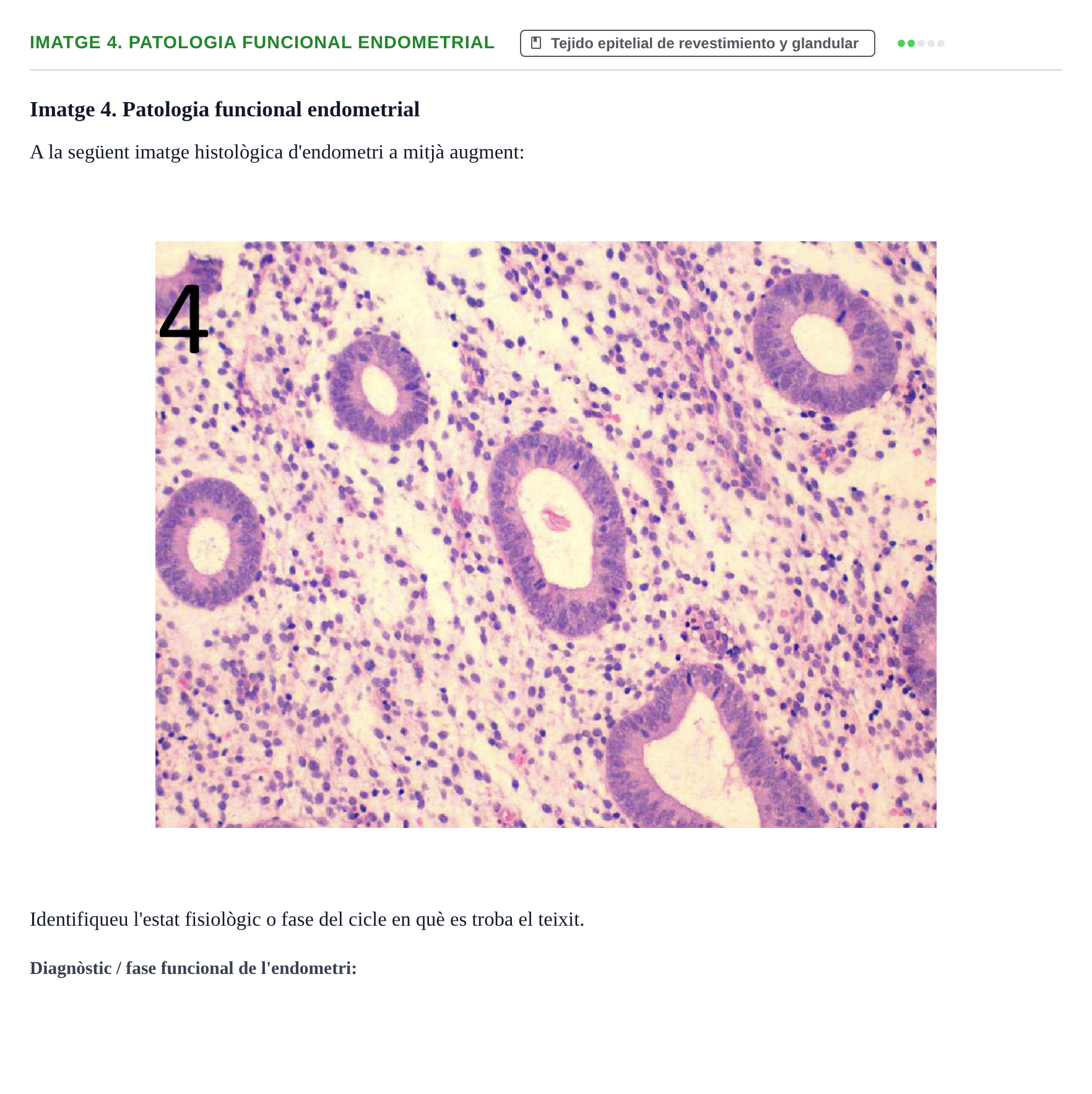 Enunciado: Ejercicio Imatge 4. Patologia funcional endometrial · Anatomia Microscòpica UDL 2015