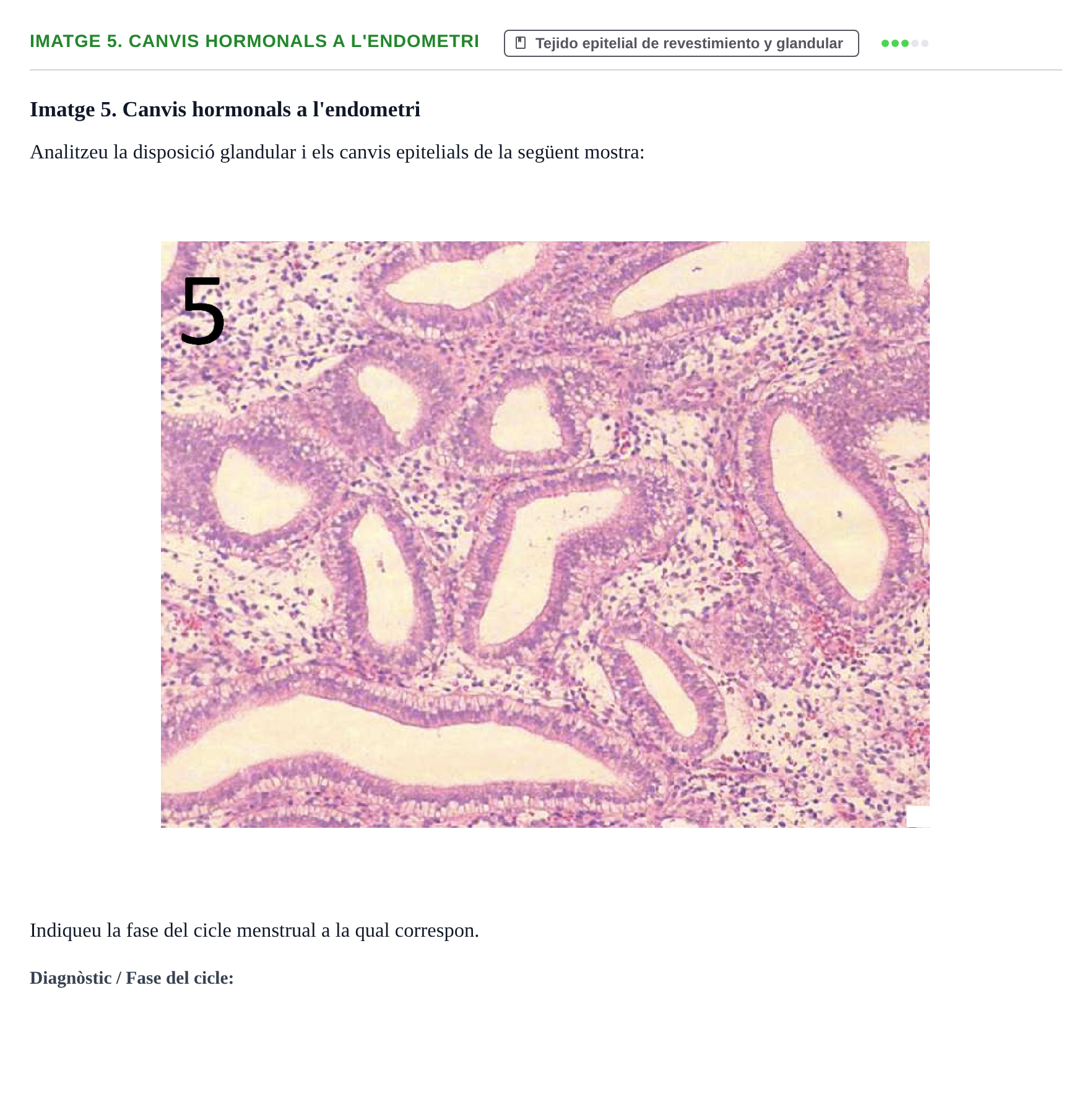 Enunciado: Ejercicio Imatge 5. Canvis hormonals a l'endometri · Anatomia Microscòpica UDL 2015