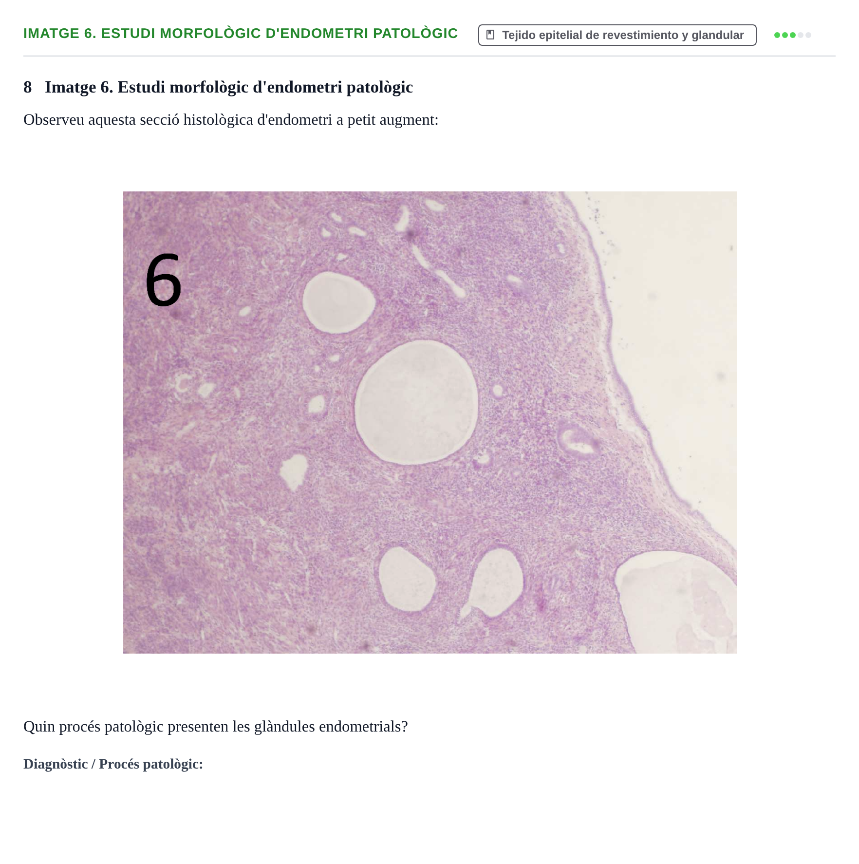Enunciado: Ejercicio Imatge 6. Estudi morfològic d'endometri patològic · Anatomia Microscòpica UDL 2015