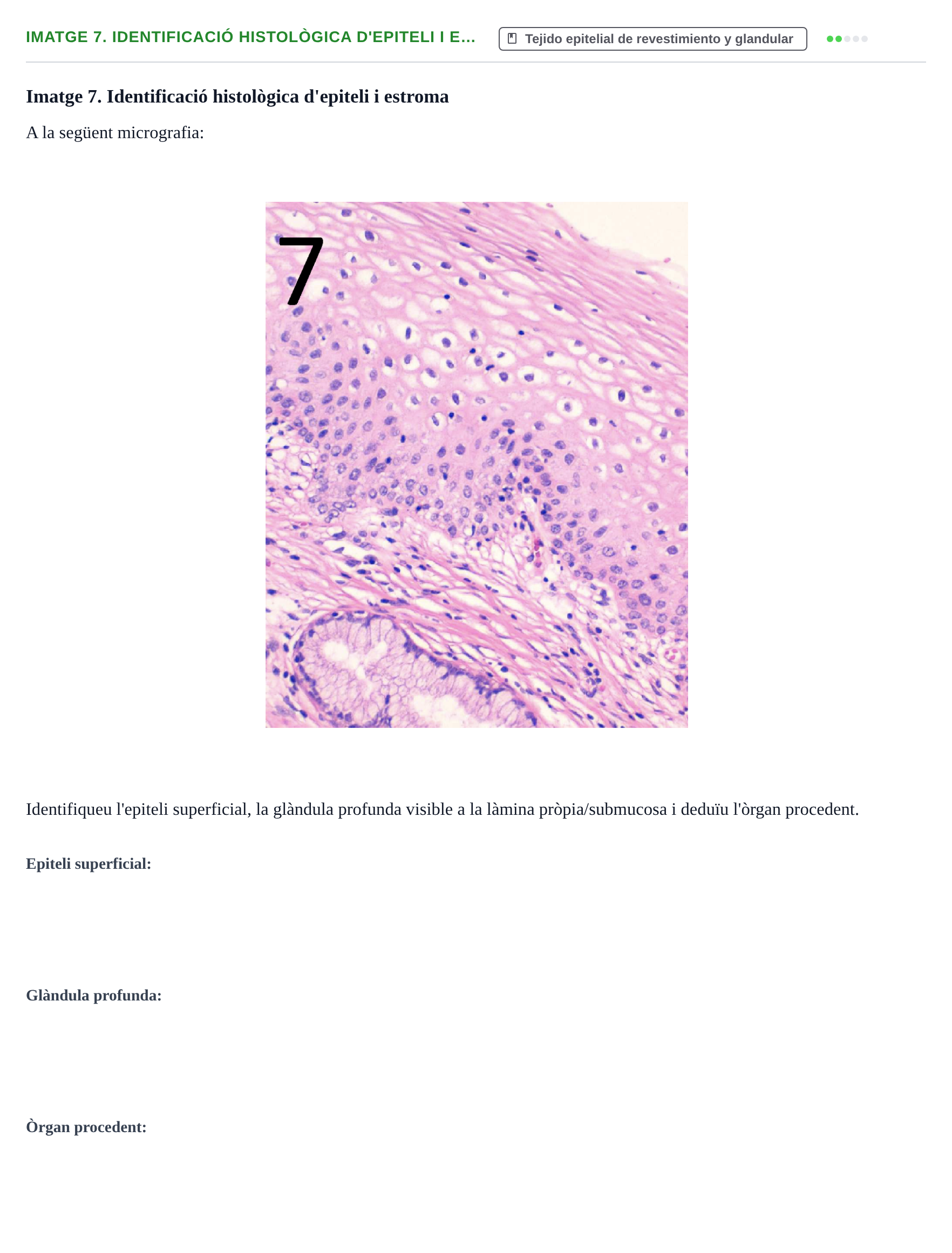 Enunciado: Ejercicio Imatge 7. Identificació histològica d'epiteli i e… · Anatomia Microscòpica UDL 2015