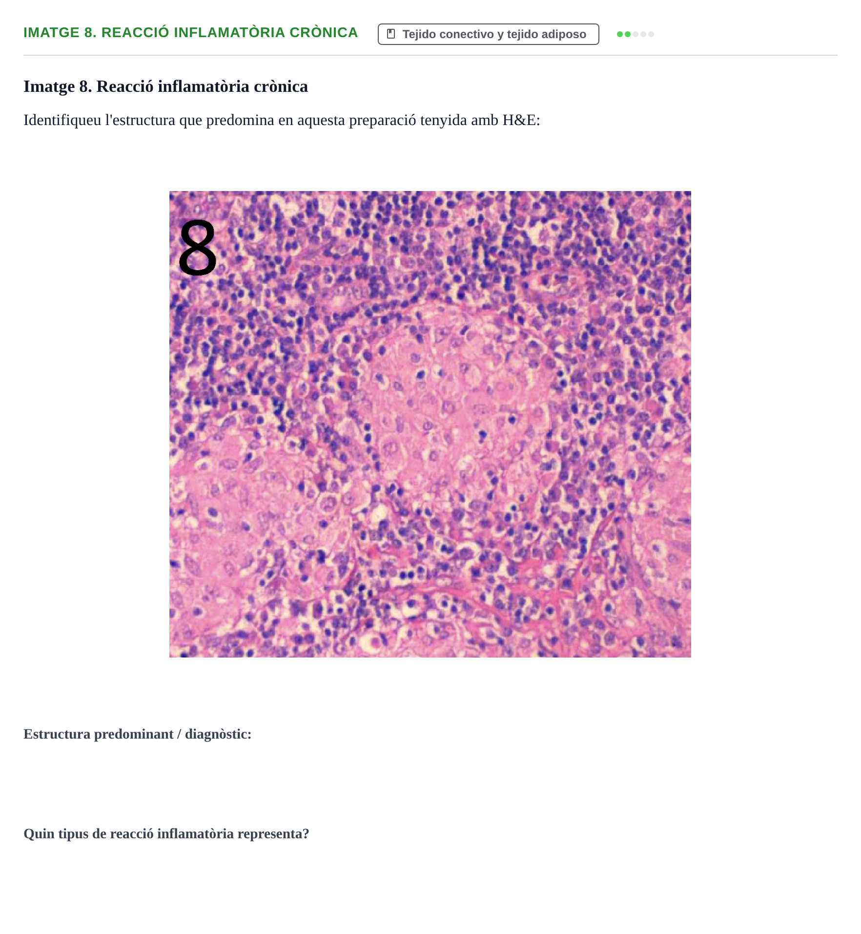 Enunciado: Ejercicio Imatge 8. Reacció inflamatòria crònica · Anatomia Microscòpica UDL 2015