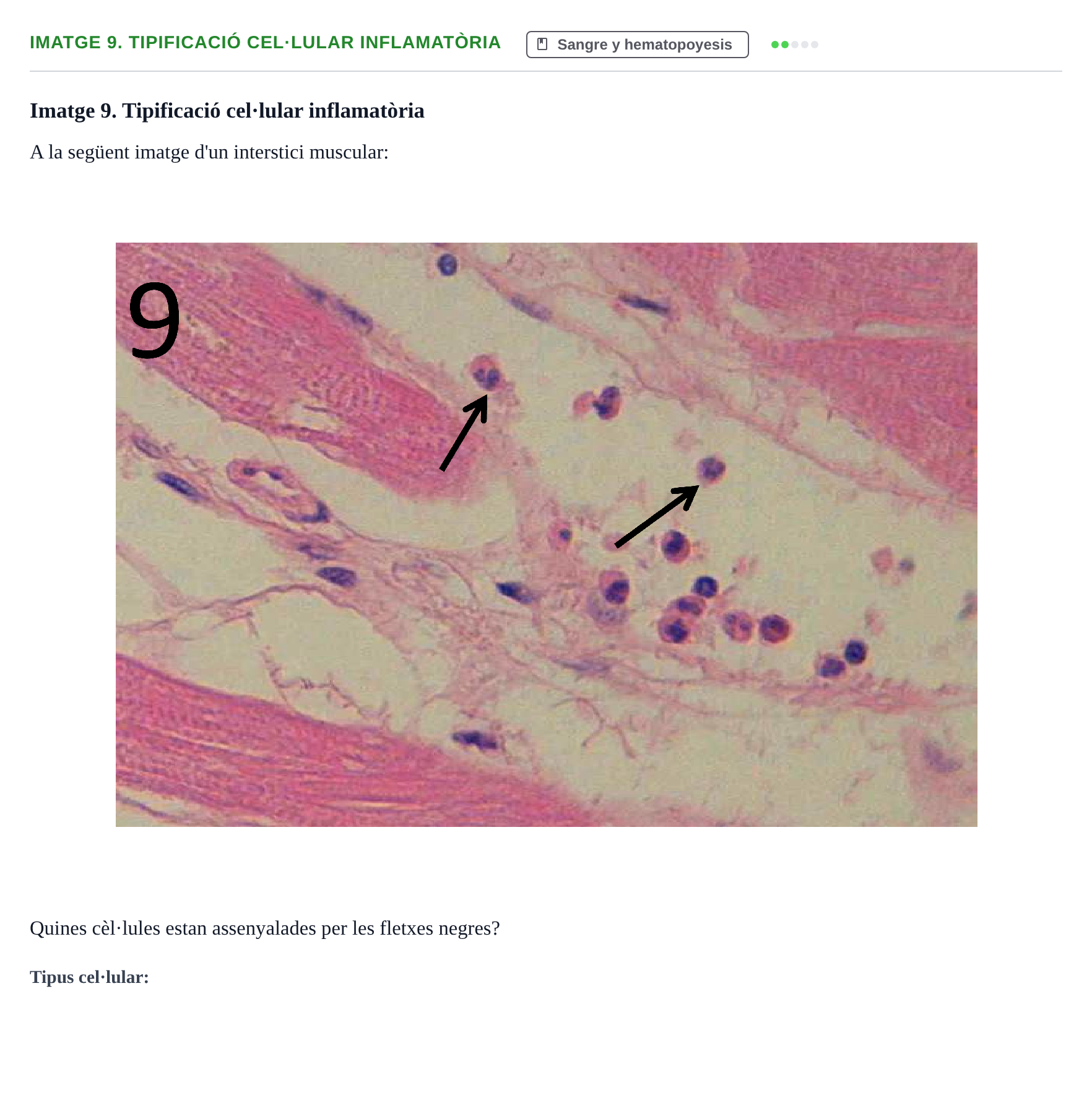 Enunciado: Ejercicio Imatge 9. Tipificació cel·lular inflamatòria · Anatomia Microscòpica UDL 2015