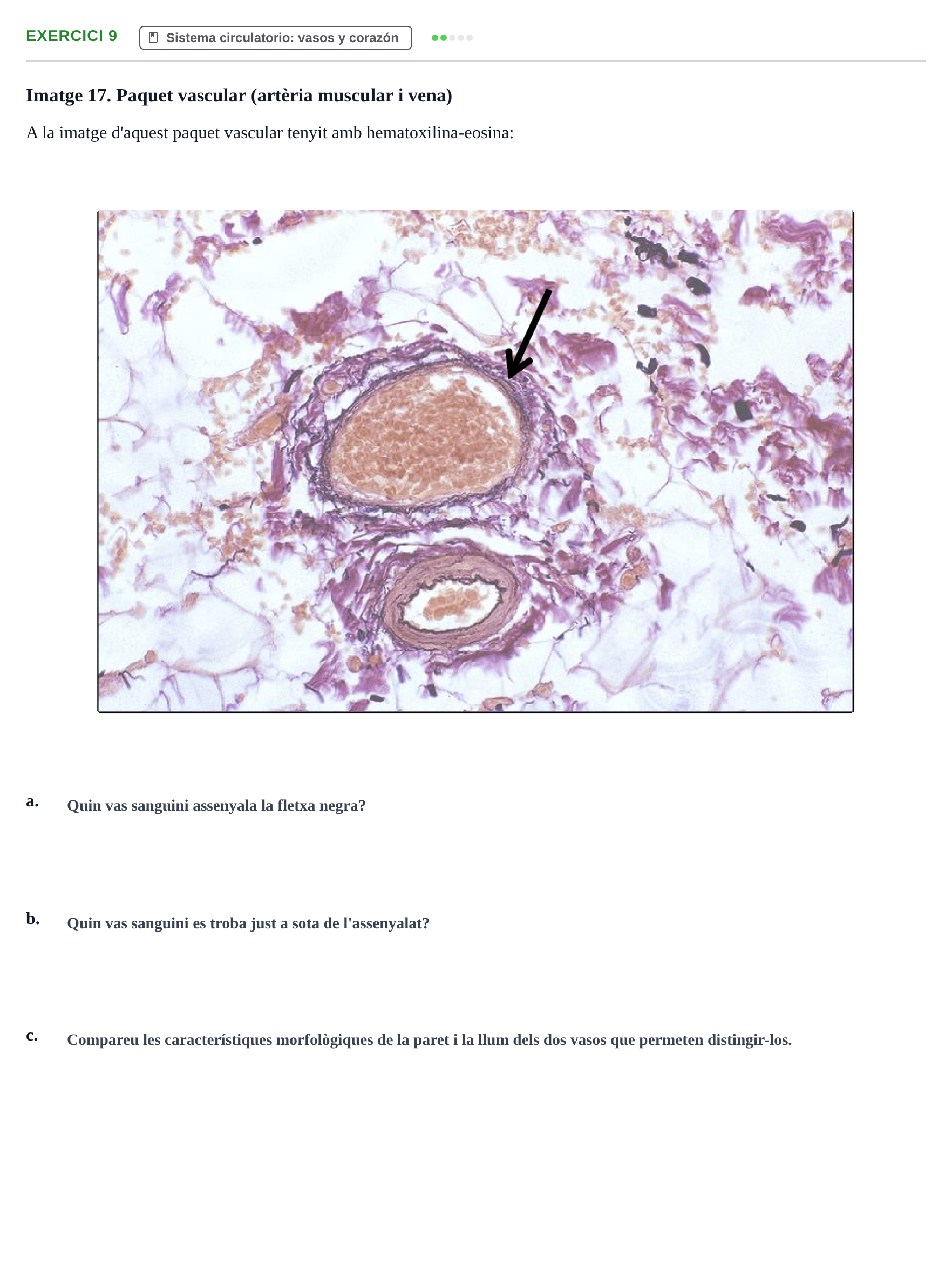 Enunciado: Problema 9 · Anatomia Microscòpica UDL 2020